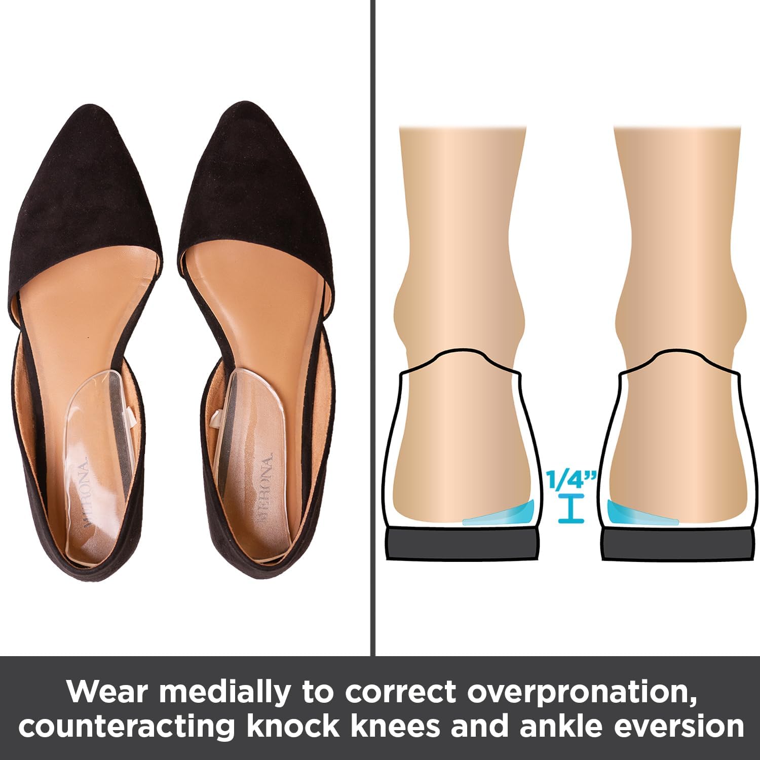 BraceAbility Medial & Lateral Heel Wedge Silicone Insoles (Pair) - Supination & Pronation Corrective Adhesive Shoe Inserts for Foot Alignment, Knock Knee Pain, Bow Legs, Osteoarthritis - Image 4