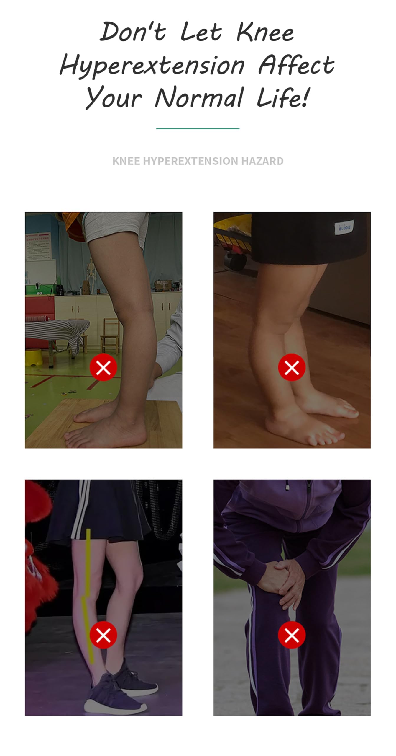 Kniebandage, Anti-Knie-Bandage bei Arthritis, vorderer Kreuzbandage und mittlerer Kreuzbandage, Bequeme B-auf-B-Knieorthese, verstellbare Knie-Wegfahrsperre zur Unterstützung bei M