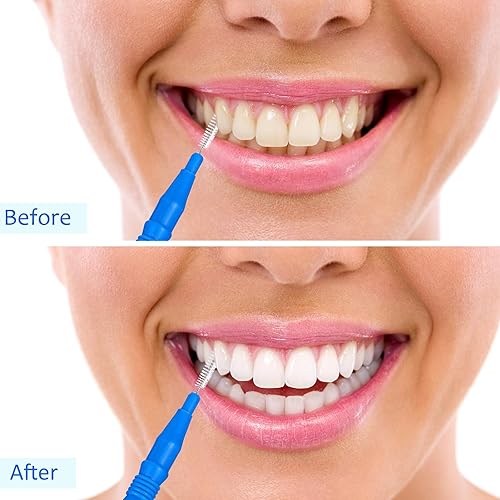 Miniatura 46 de BBTO 100 piezas de llaves de cepillo dental para limpiador interdental, palillo de dientes, cabezal de hilo dental, limpiador oral de palillos Rojo