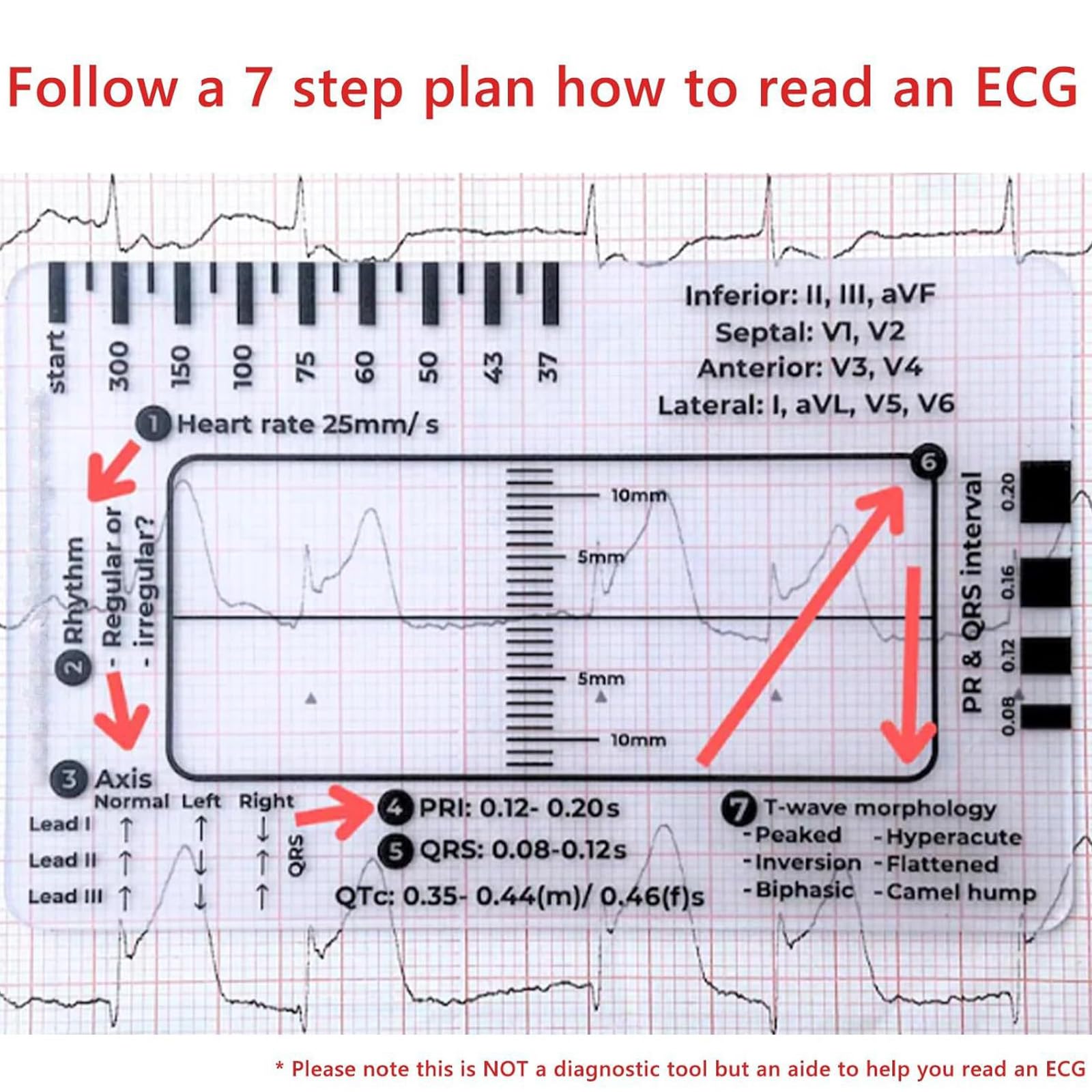 Tarjeta de regla de electrocardiograma de 7 pasos para una interpretación precisa y un análisis rápido en la herramienta de evaluación de configuración médica, herramienta de diagnóstico