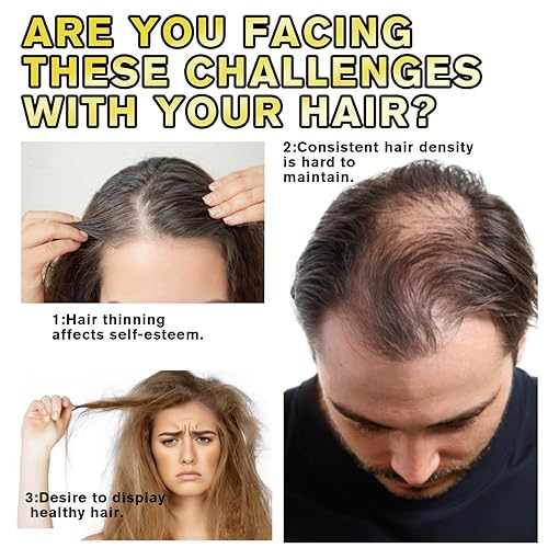 Miniatura 2 de 5% de crecimiento del cabello de minoxidil para hombres y mujeres, suero de crecimiento del cabello de minoxidil, promueve el crecimiento del