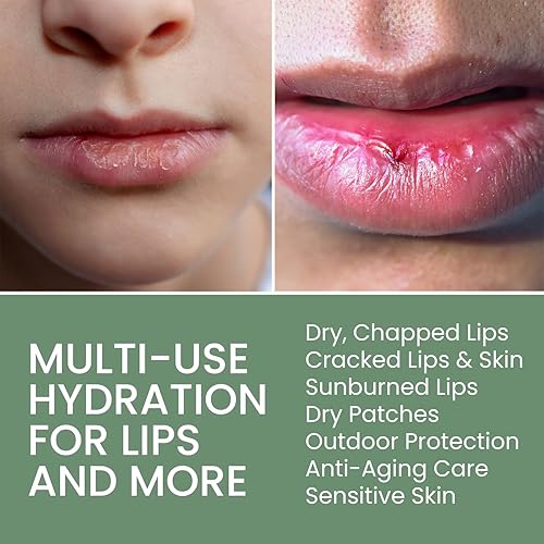 Miniatura 4 de THENA Crema curativa intensiva para tratamiento de eccema cuero cabelludo psoriasis picazón seca erupciones de rosácea dermatitis seborreica cuero