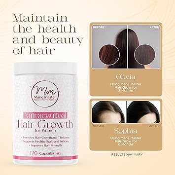 Hair Growth Supplement for Women 120 Capsules Hair Loss Treatment for Women Hair Supplements for Thicker, Stronger Hair Hair Growth Pills with Biotin & Vitamins for Fast Results