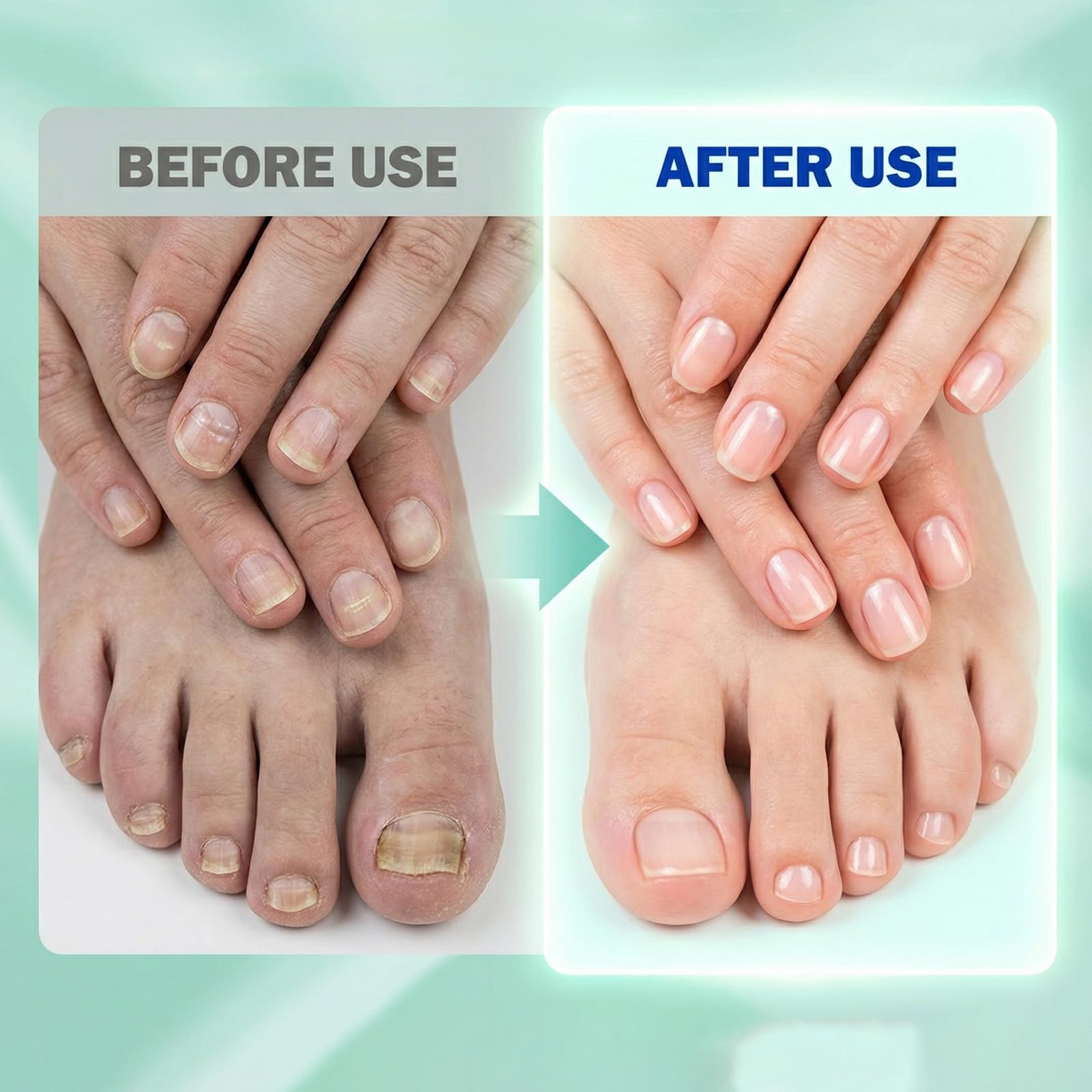 21 Pezzi Fungal Nail Patches con 1 Cuscinetto Antiusura, Cerotti per Micosi Delle Unghie, Micosi Unghie Piede