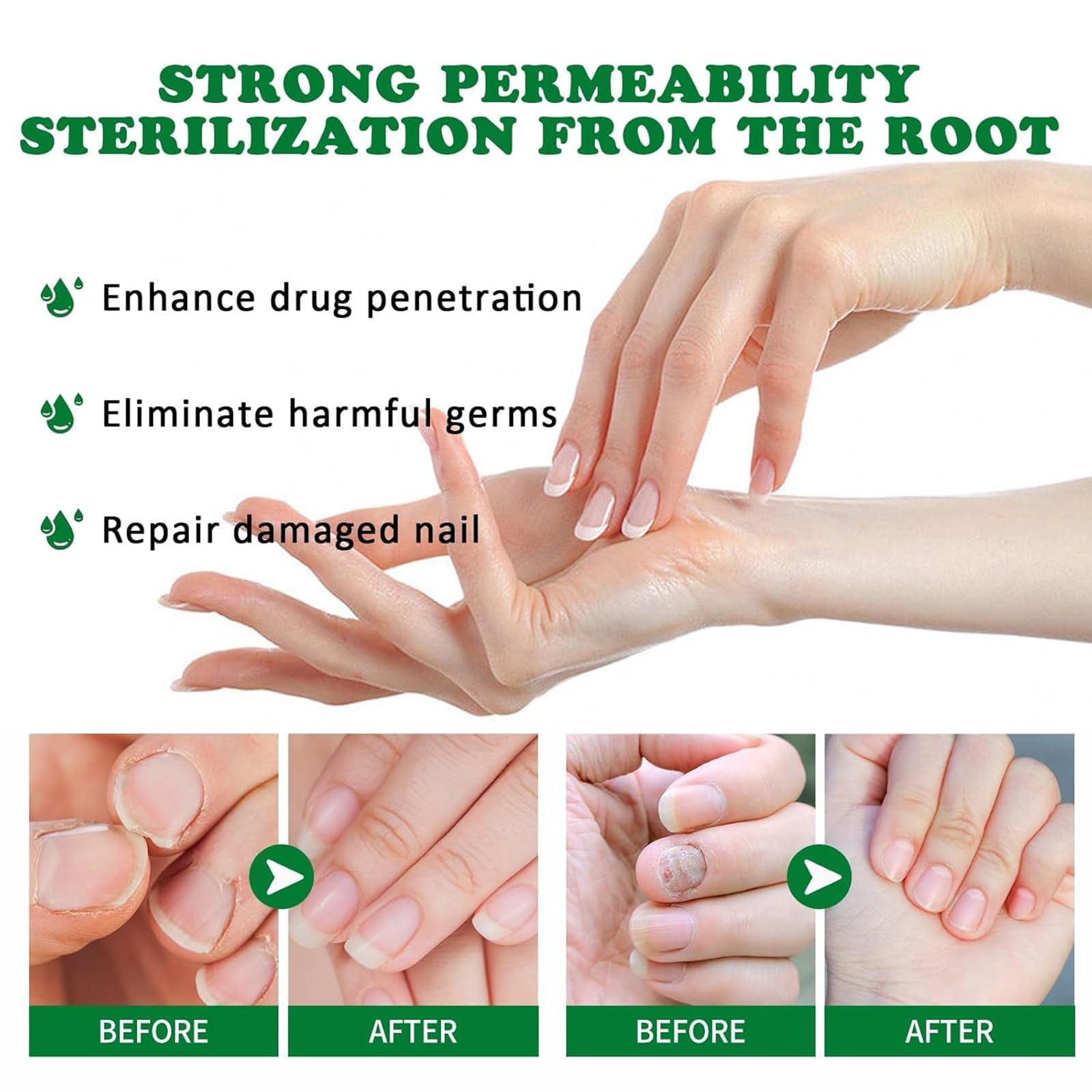 Tratamiento de hongos de uñas de 7 días, soporte de uñas de jengibre CUIDADO, 1 FL.OZ Multi-usose uñas de reparación de suero, para uñas finas, frágiles, peladas y agrietadas (2pcs)