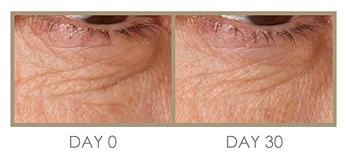 Miniatura 4 de Genie H 'Eye 'drator Eye Crema