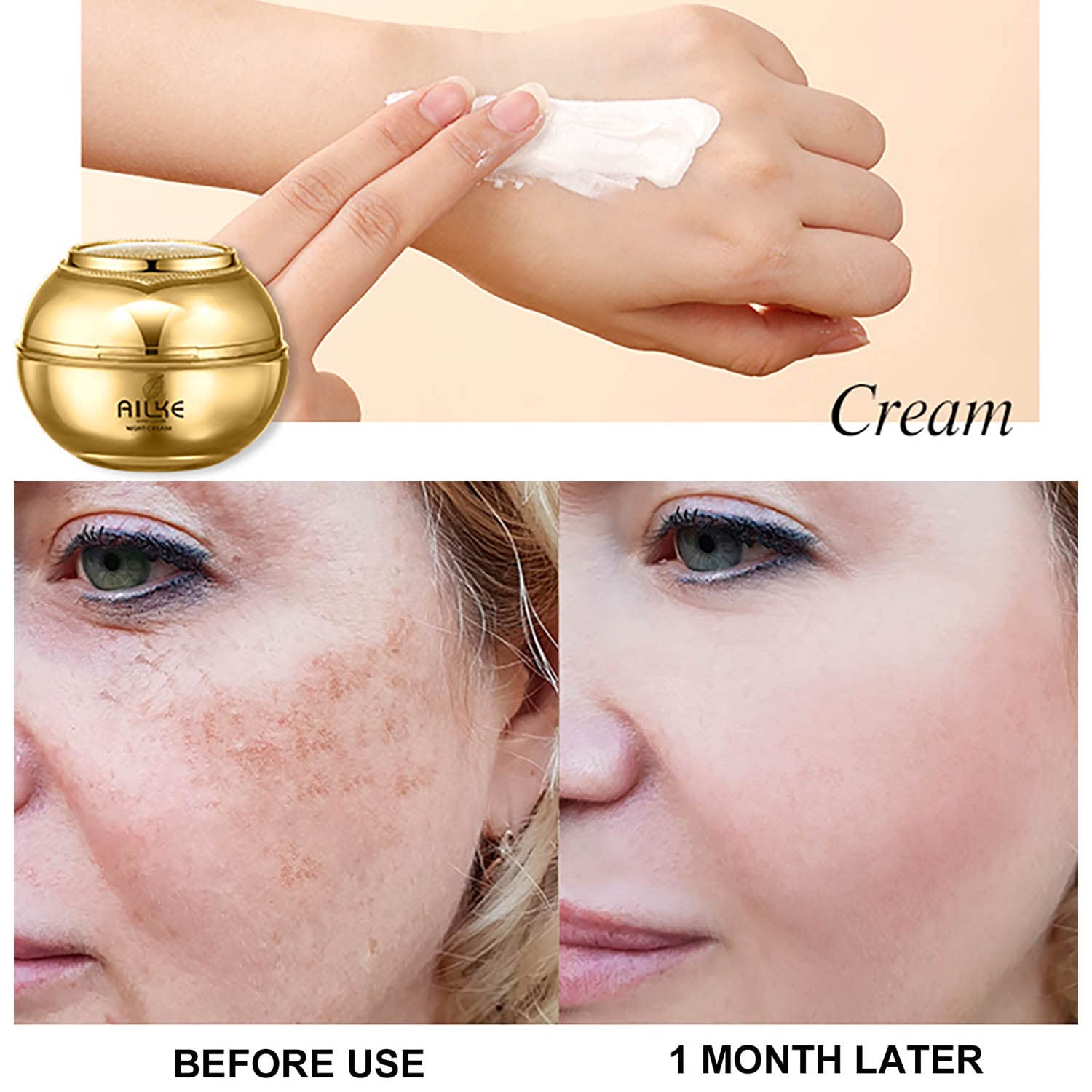 Sbiancante al collagene di qualità superiore, crema antimacchie scure, antimacchie, antimacchie, kit 5 in 1 con detergente per il viso, toner, sem, crema giorno e notte