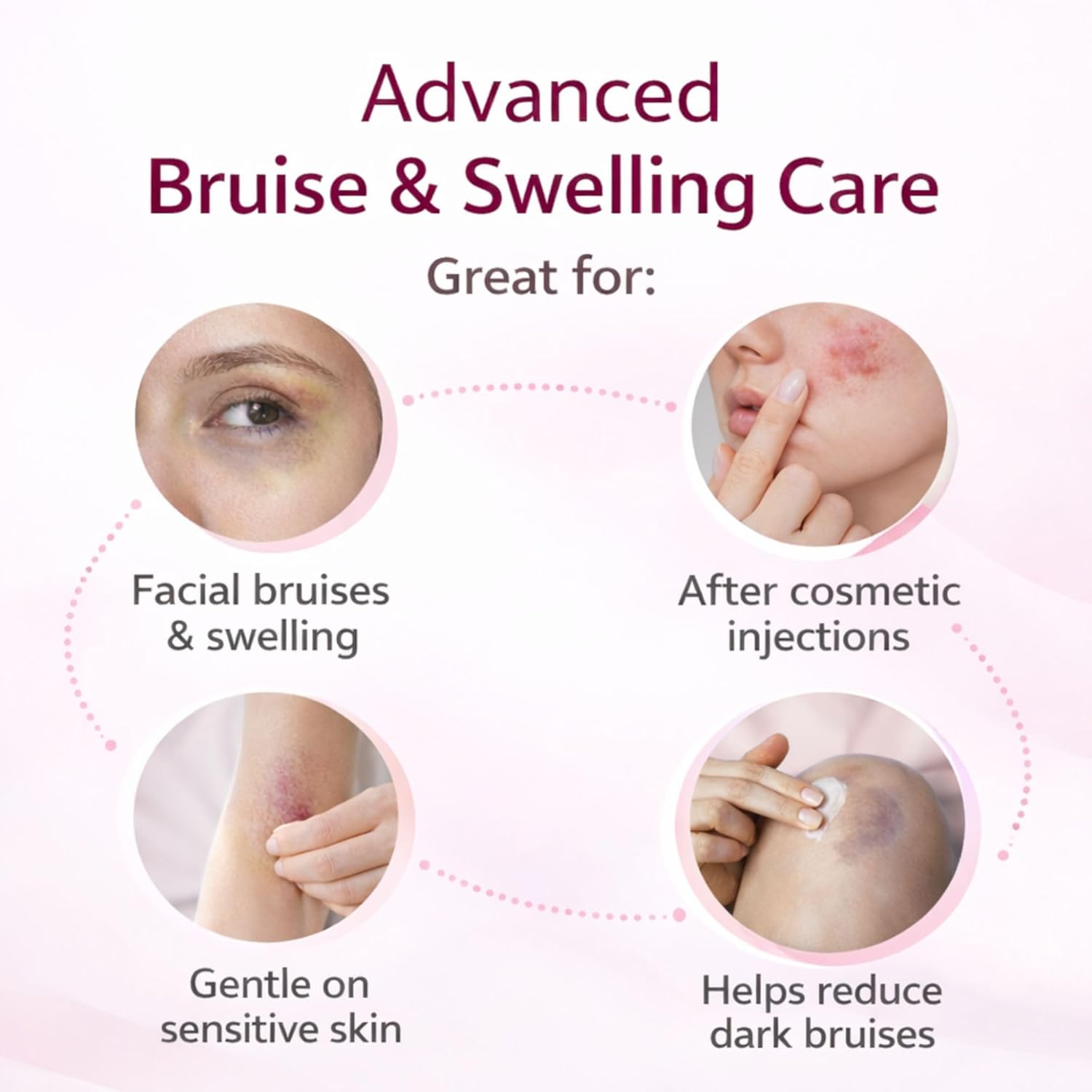 Bruise Cream with Vitamin K|Moisturizing & Firming Formula for Arms, Legs & Hands|Restores Fragile Skin with Anti-Wrinkle Benefits (Scentless)