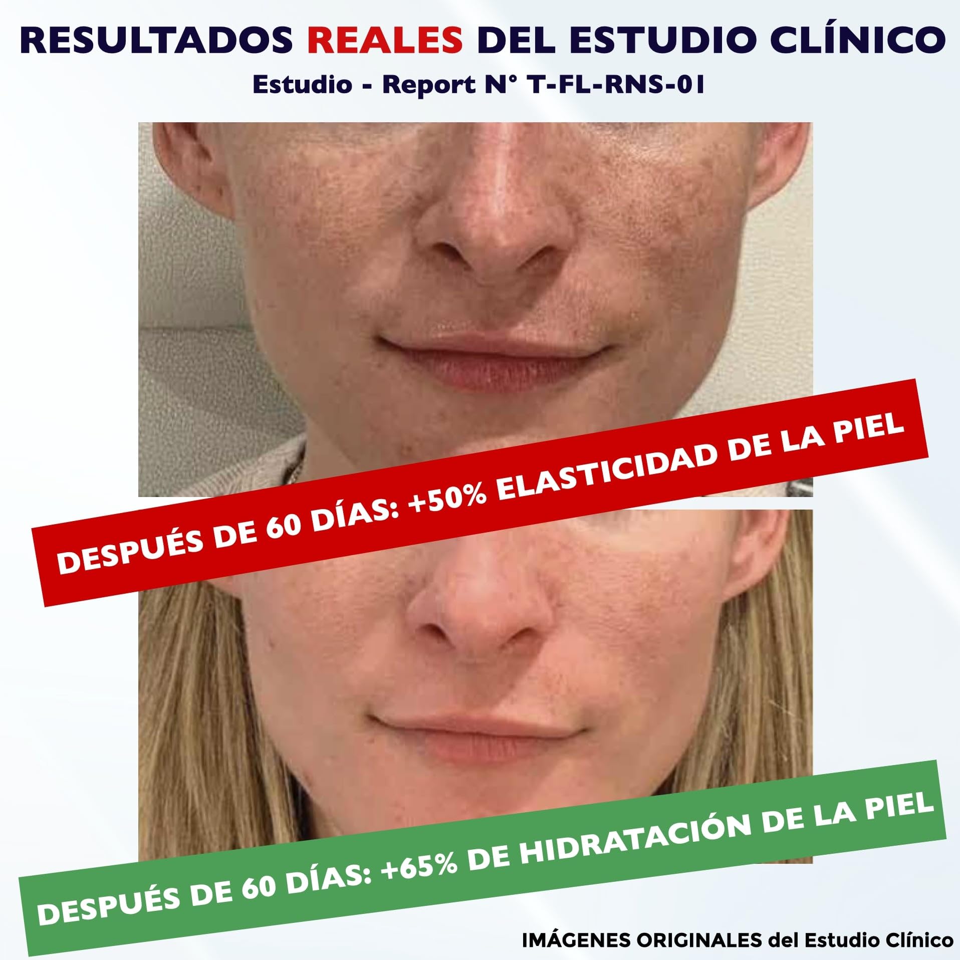 100 ml. Bio Crema Hidratante al Retinol para la Cara y Contorno de Ojos. Crema Facial Mujeres y Hombres Anti-Edad Antiarrugas y Antiojeras con Ácido Hialurónico y Vitamina C. Crema de Noche y Día - 5