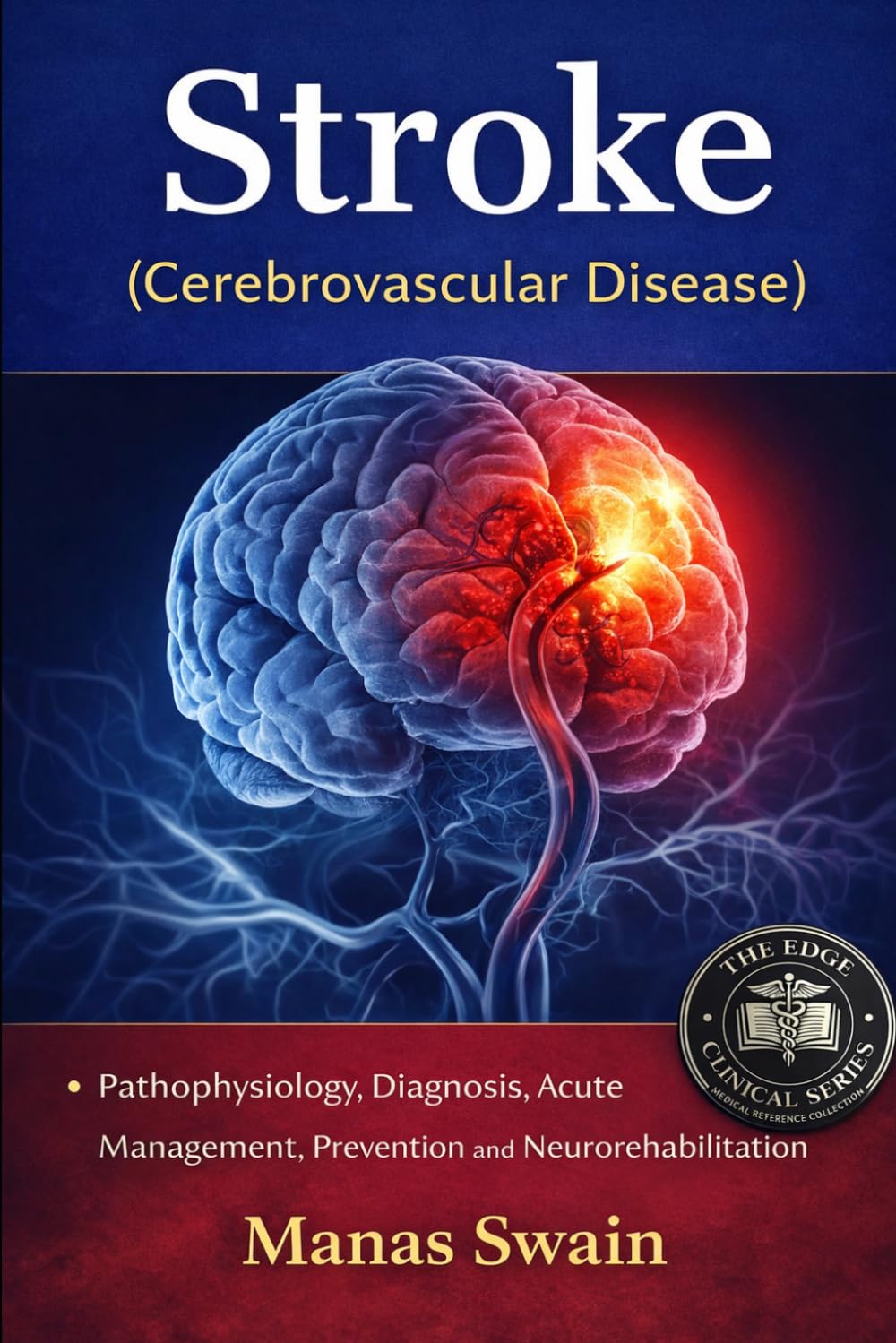 Stroke (Cerebrovascular Disease): Pathophysiology, Diagnosis, Acute Management, Prevention and Neuro-rehabilitation