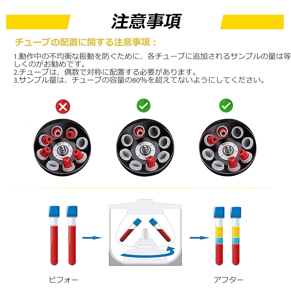 110v-220V遠心分離機デジタル低速脂肪美容 4000rpm 1920Xg 110v-220V遠心分離機デジタル低速脂肪美容 4000rpm 1920Xg