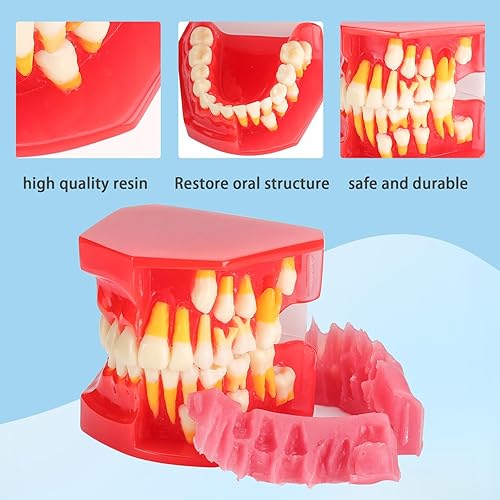 Miniatura 3 de Modelo de desarrollo de erupción dental: modelo alternativo de presión constante de dientes caducifolios claramente para mostrar el proceso de