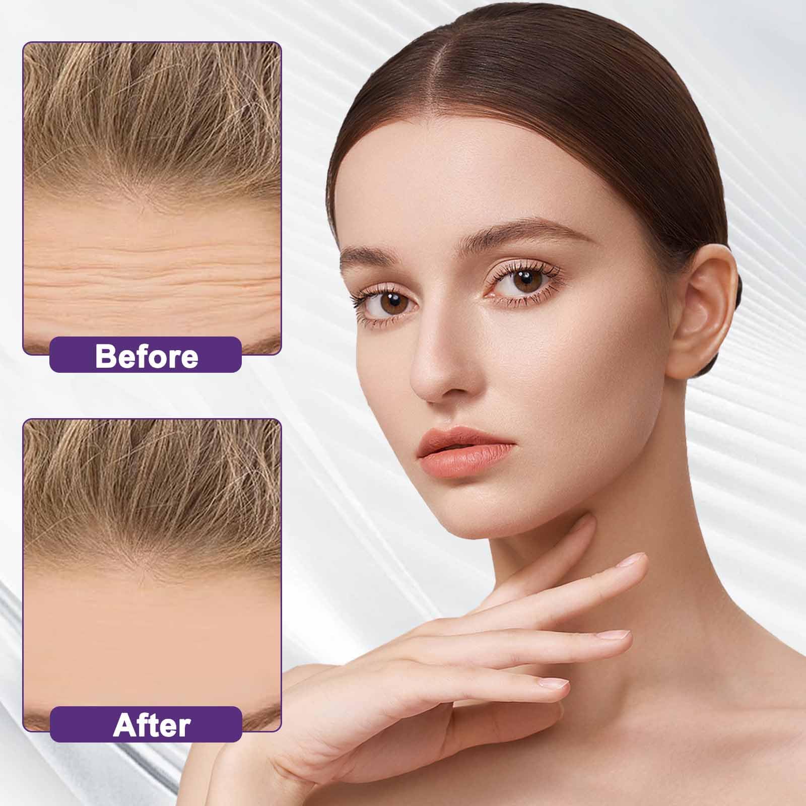 Forehead Wrinkle Patches,Forehead Patches For Wrinkles Forehead Patches For Line Remover Patches Smoothing Facial Anti-Wrinkle Patches Moisturizing Mask Pads For Women Age Lines Resistant Patches - Image 3