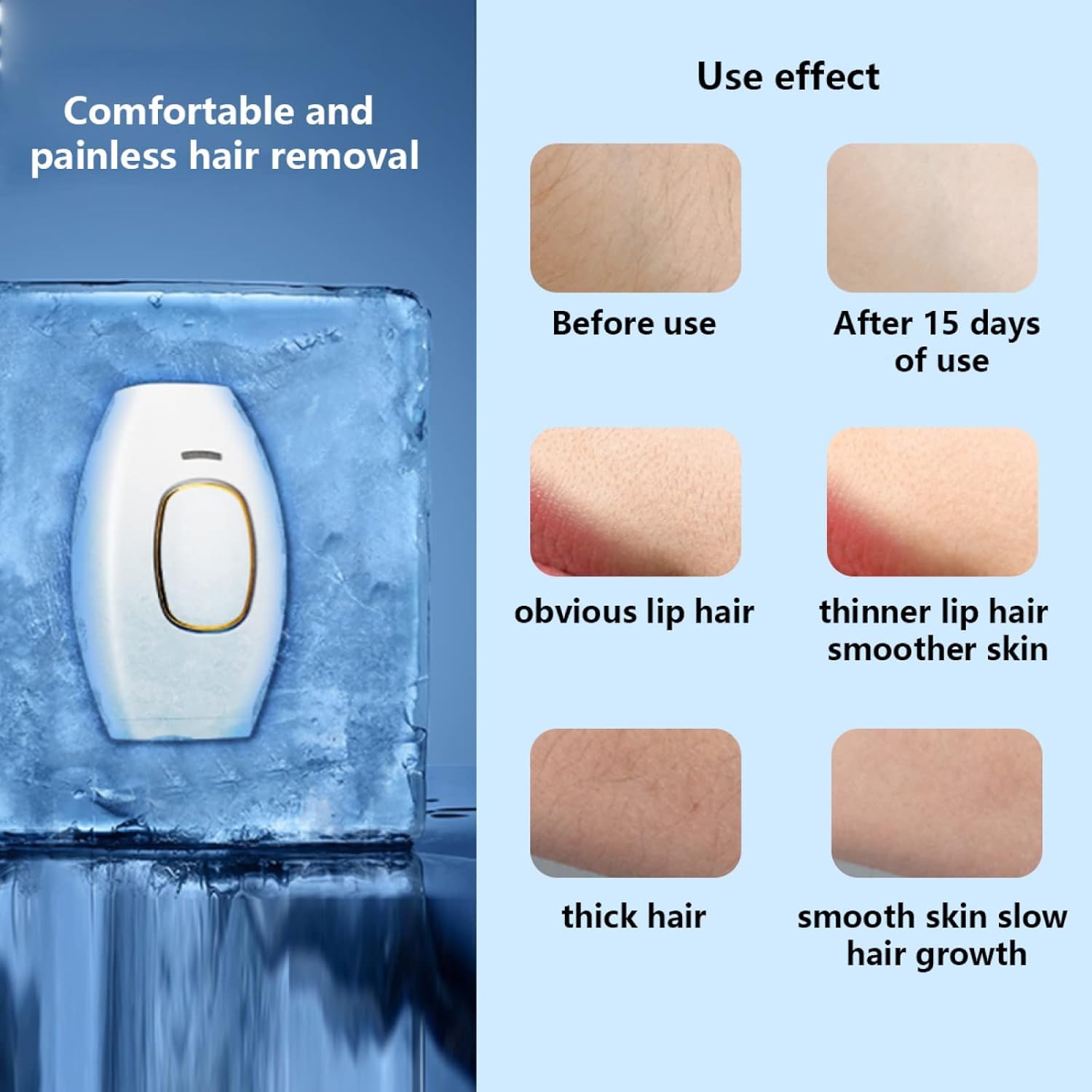 épilateur laser portable, Épilation au laser de 5 minutes, Épilateur laser pour femmes hommes, Convient à toutes les parties du corps (blanc)