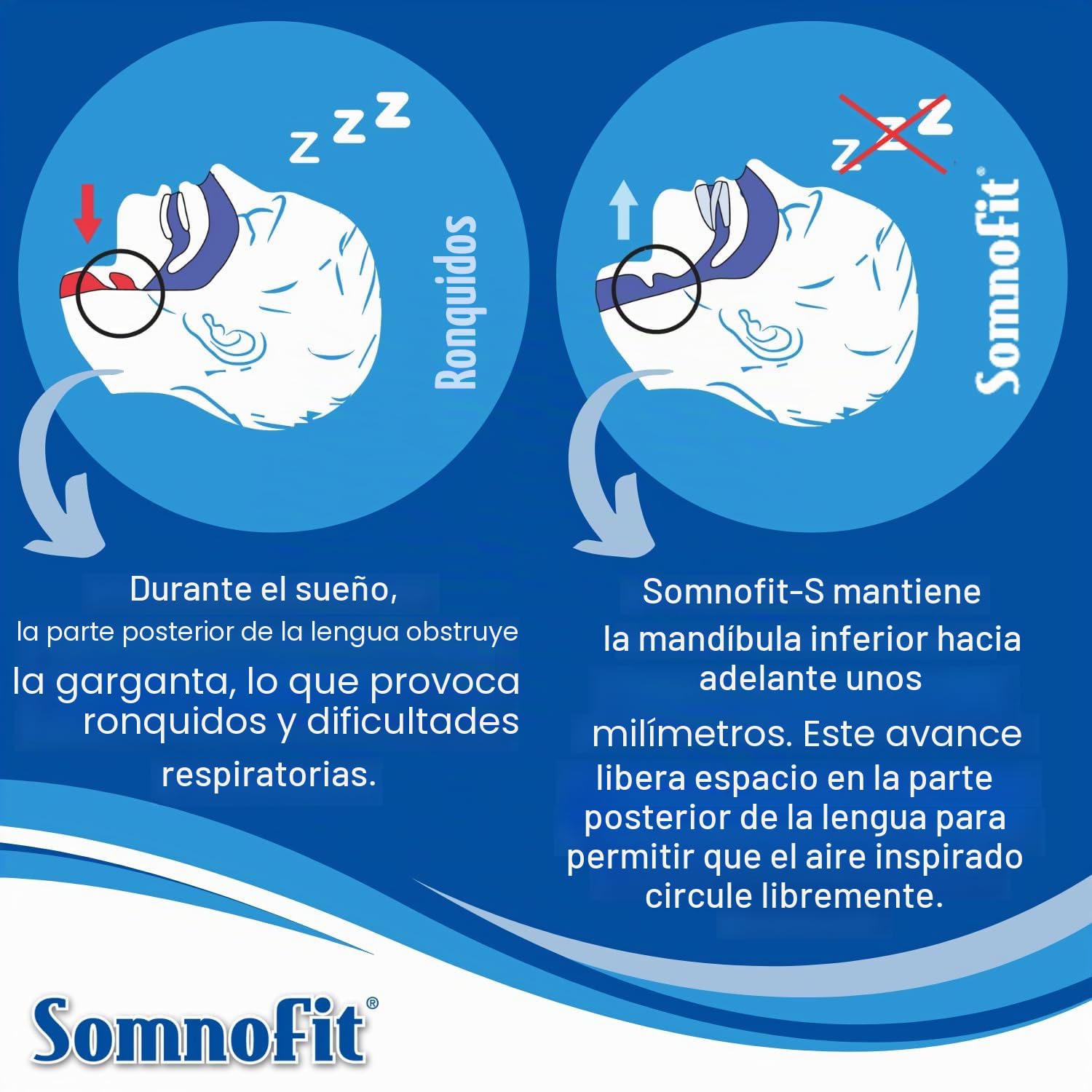 Somnofit – Ortesis antironquidos y apnea – Canal dental flexible y termoformable – Diseño patentado, gran comodidad – Ortesis mandibular fabricada en Suiza