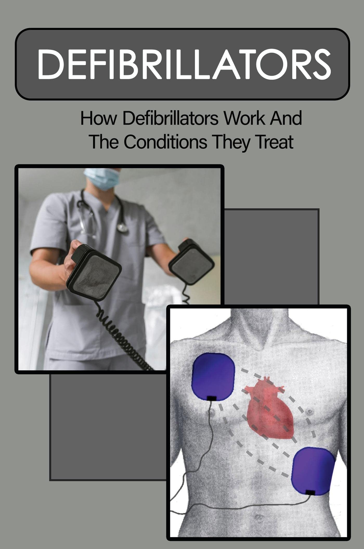 Defibrillators: How Defibrillators Work And The Conditions They Treat
