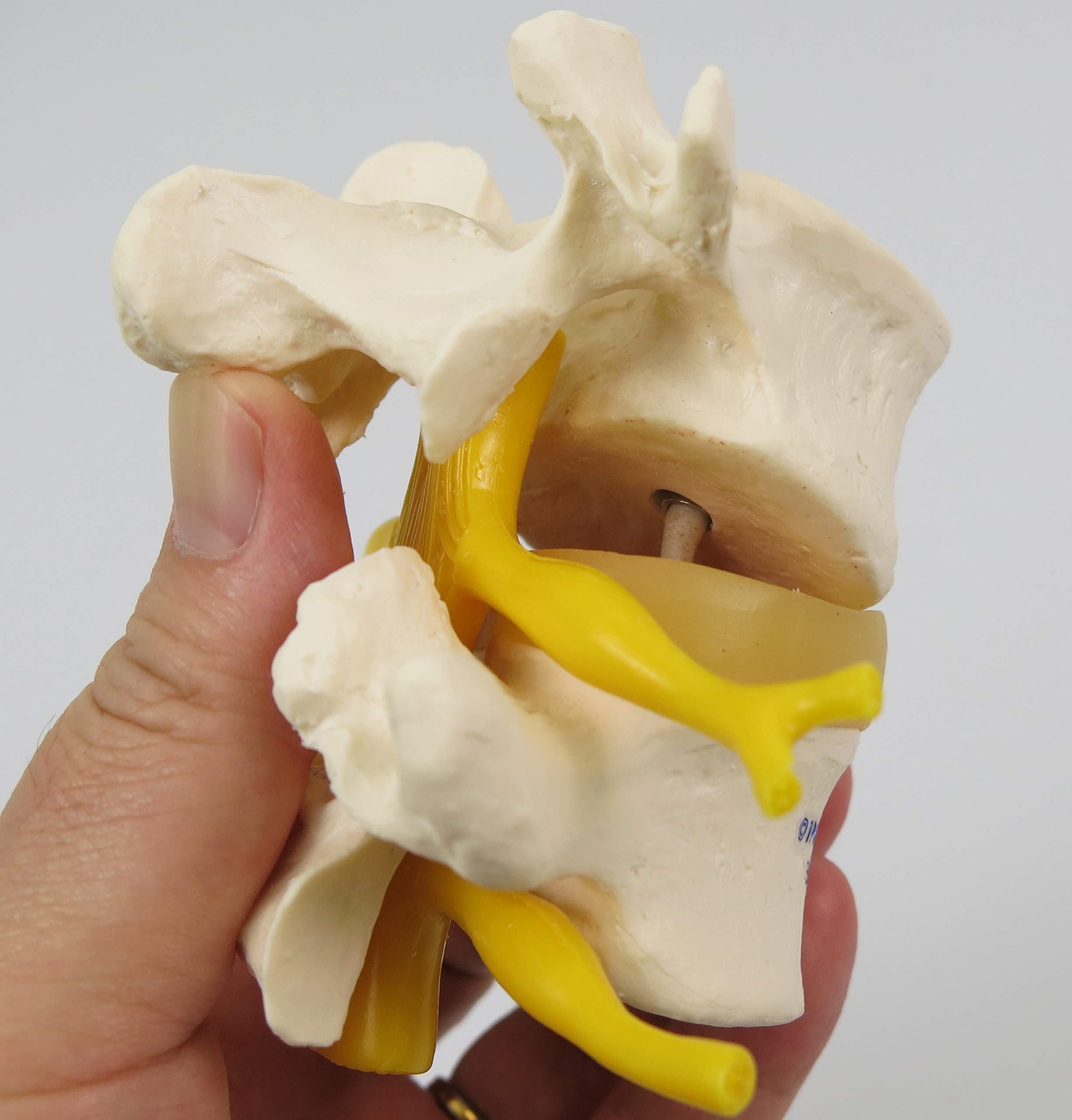 3B Scientific® 2 Vertèbres Lombaires avec Hernie Discale – Modèles Anatomiques Montés de Manière Flexible + Smart Anatomy App (Garantie de 5 Ans)