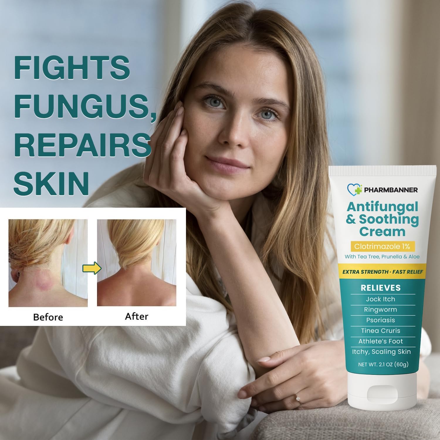 Best Antifungal Cream - Fast Relief for Jock Itch & Ringworm Review