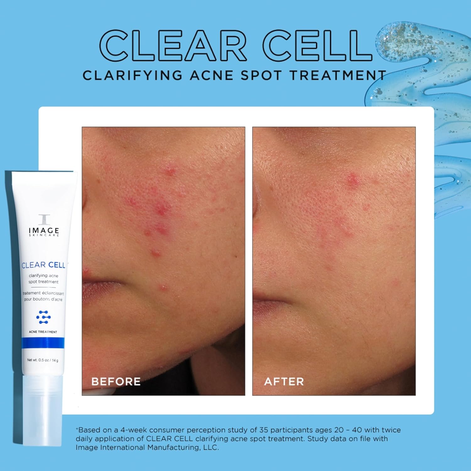 IMAGE Skincare, CLEAR CELL Clarifying Acne Spot Treatment, with Salicylic Acid, Targets Existing Acne Blemishes while Preventing New Blemishes from Forming, 0.5 oz - Image 6