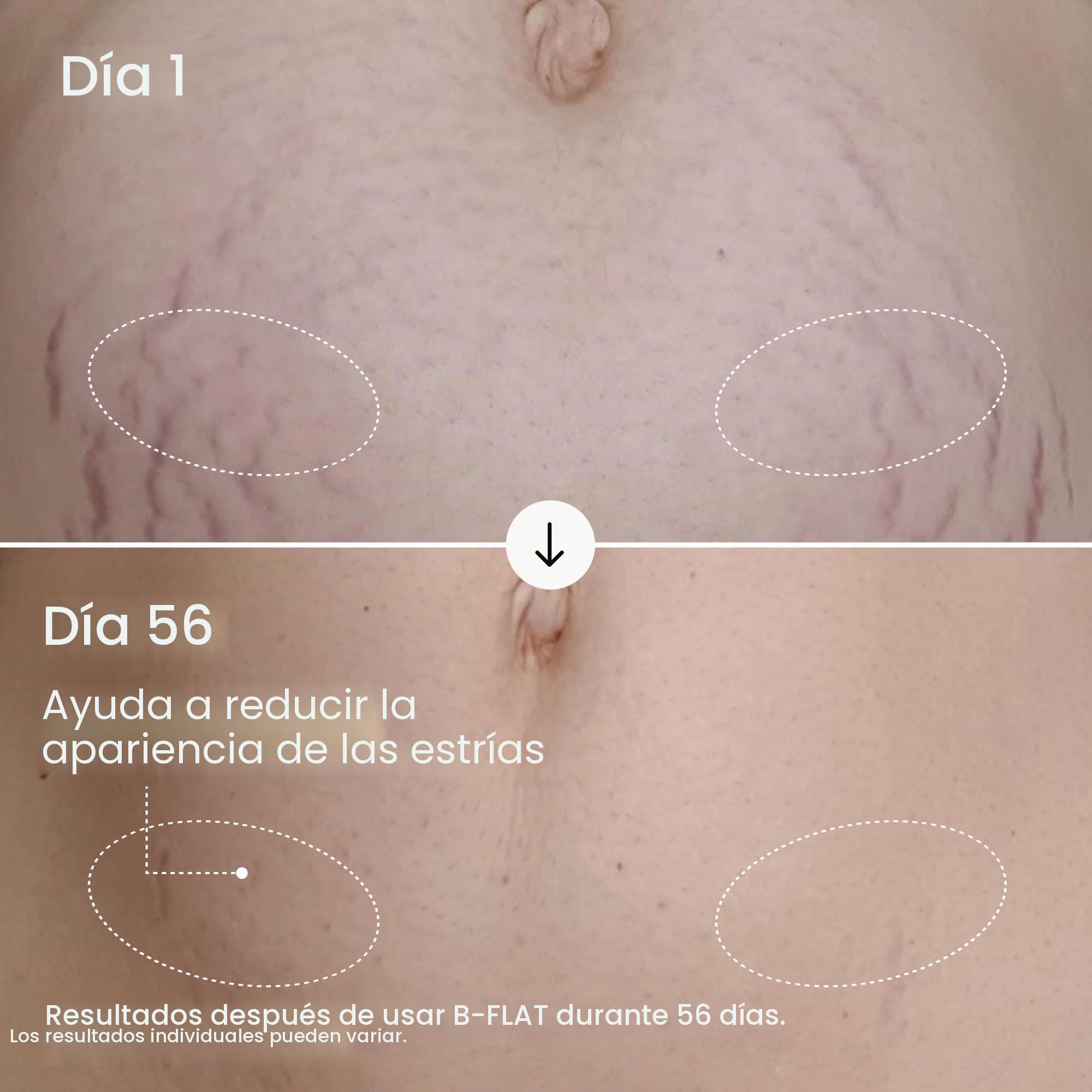 MAELYS Maëlys Cosmetics B-Flat Crema reafirmante para barriga plana (paquete de 3)