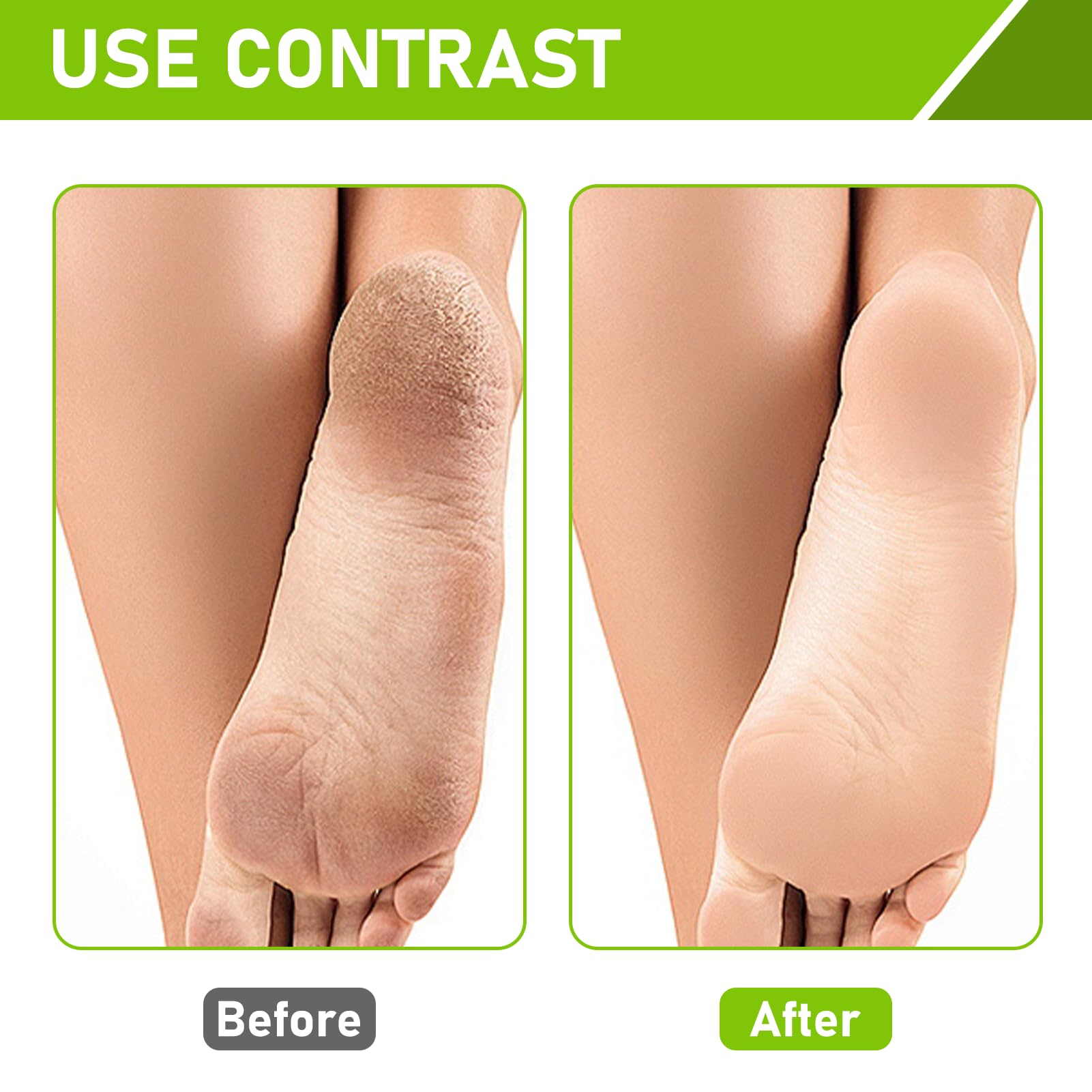 2 Paires Masque Pied, Masque Pied Exfoliant Peeling pour Pieds Très Secs et Abîmés, avec Acide Lactique Naturel, Olive et Glycérine, Soin Nourrissant et Hydratant pour Tous Types de Peau.