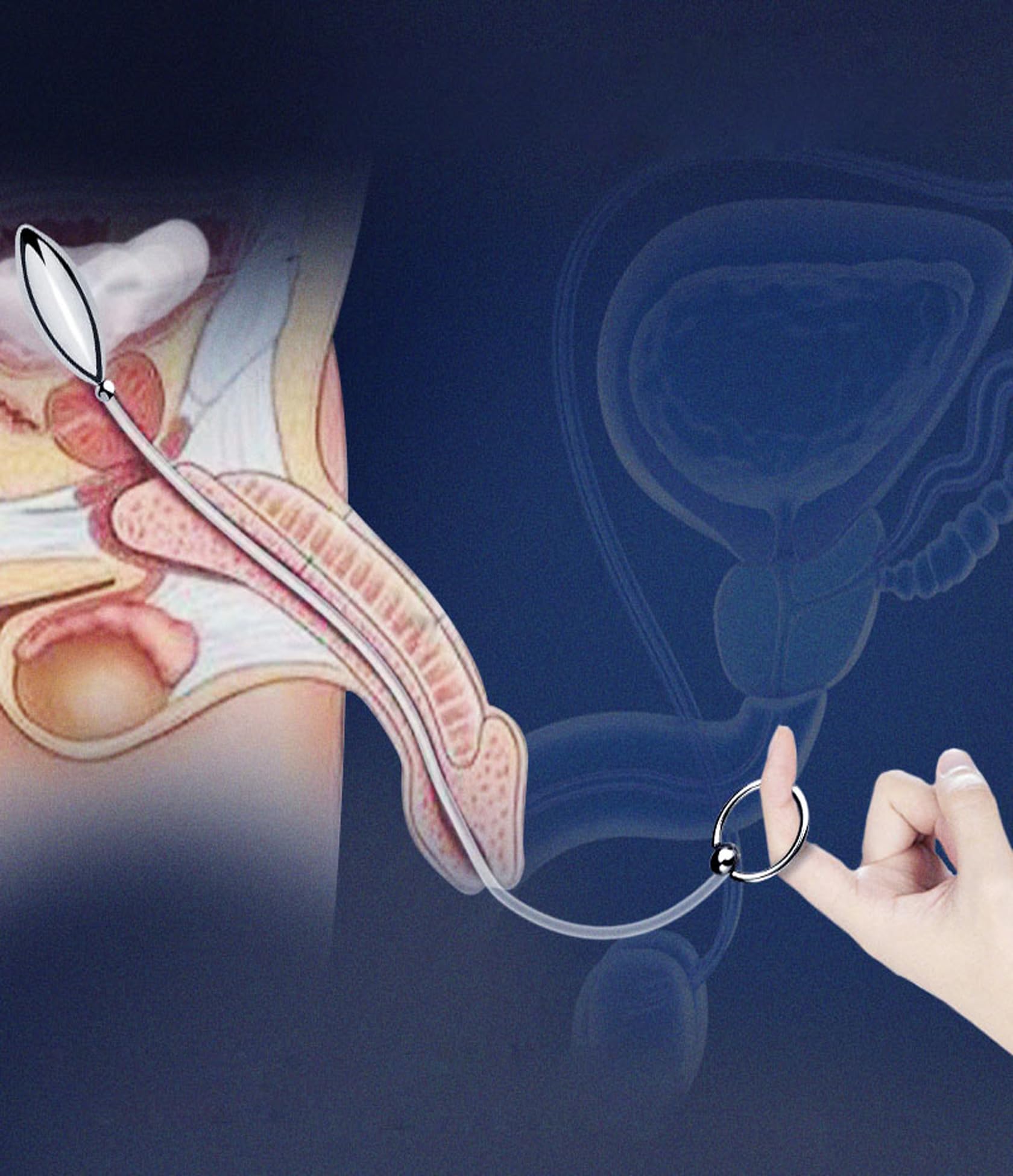 Spina del pene dilatatori uretrali dell'uretra a sfera in acciaio inossidabile con anello di trazione(6 Stück)
