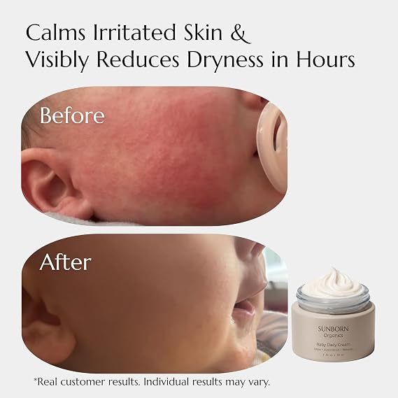 Baby Daily Cream | 100% Natural Moisturizer for Eczema, Irritated & Dry Skin | Lab Tested, Made in USA