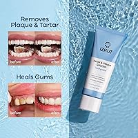 Vista 5 de Plaque & Tartar Remover Toothpaste for Teeth: Removes Plaque & Controls Tartar Build-up - Long-Lasting Fresh Breath, Deep Cleansing & Gum-Friendly