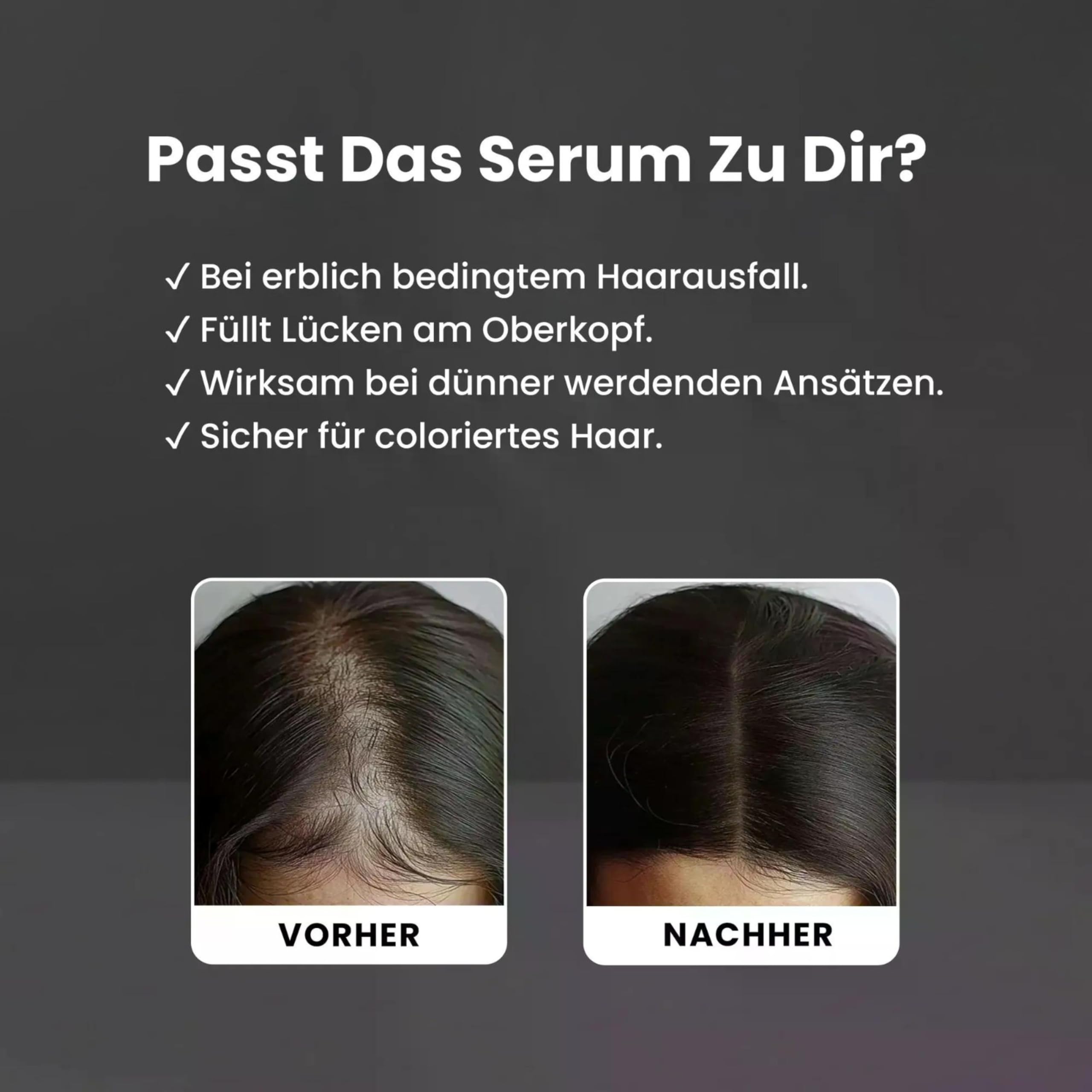 Redensyl Siero per la crescita dei capelli al 5%, 80 ml, ad alto dosaggio, contro la caduta dei capelli, siero per una crescita più rapida dei capelli e più volume, con ginseng e palma, per