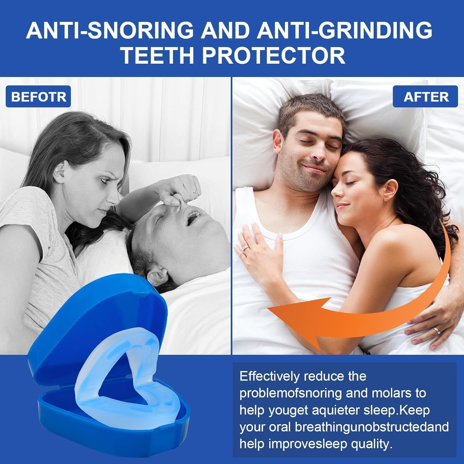 Honex The Quiet Anti-Snoring Mouthpiece Universal Size,Anti-Schnarch-Zahnschiene Für Einen Ruhigen Schlaf (2pcs)