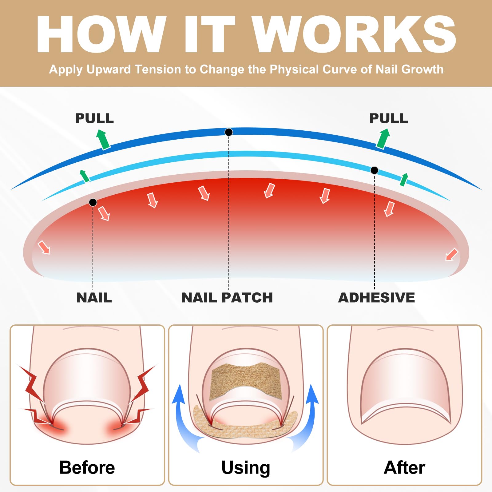 Ingrown Toenail Treatment, 50Pcs Breathable Corrector Patch, 30Pcs Ingrown Toenail Strips, Painless Ingrown Toenail Corrector Set with 2 Pedicure Tools, Not Easy to Fall Off