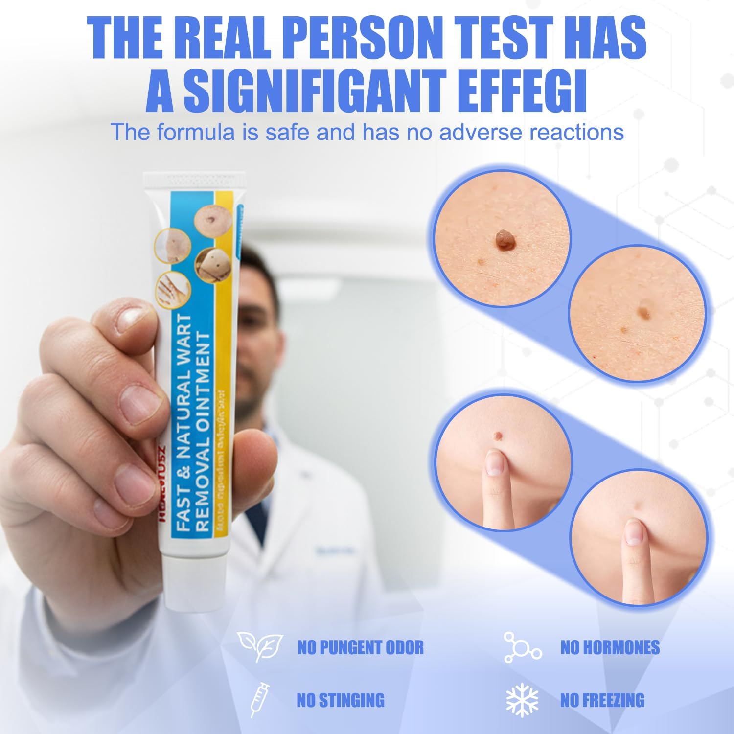 HEALMUSZ Wart Remover Cream,17% Salicylic Acid Fast-Acting to Remove HPV Warts and Common, Flat, Plantar Warts.(NDC:84010-092-01) - Image 5