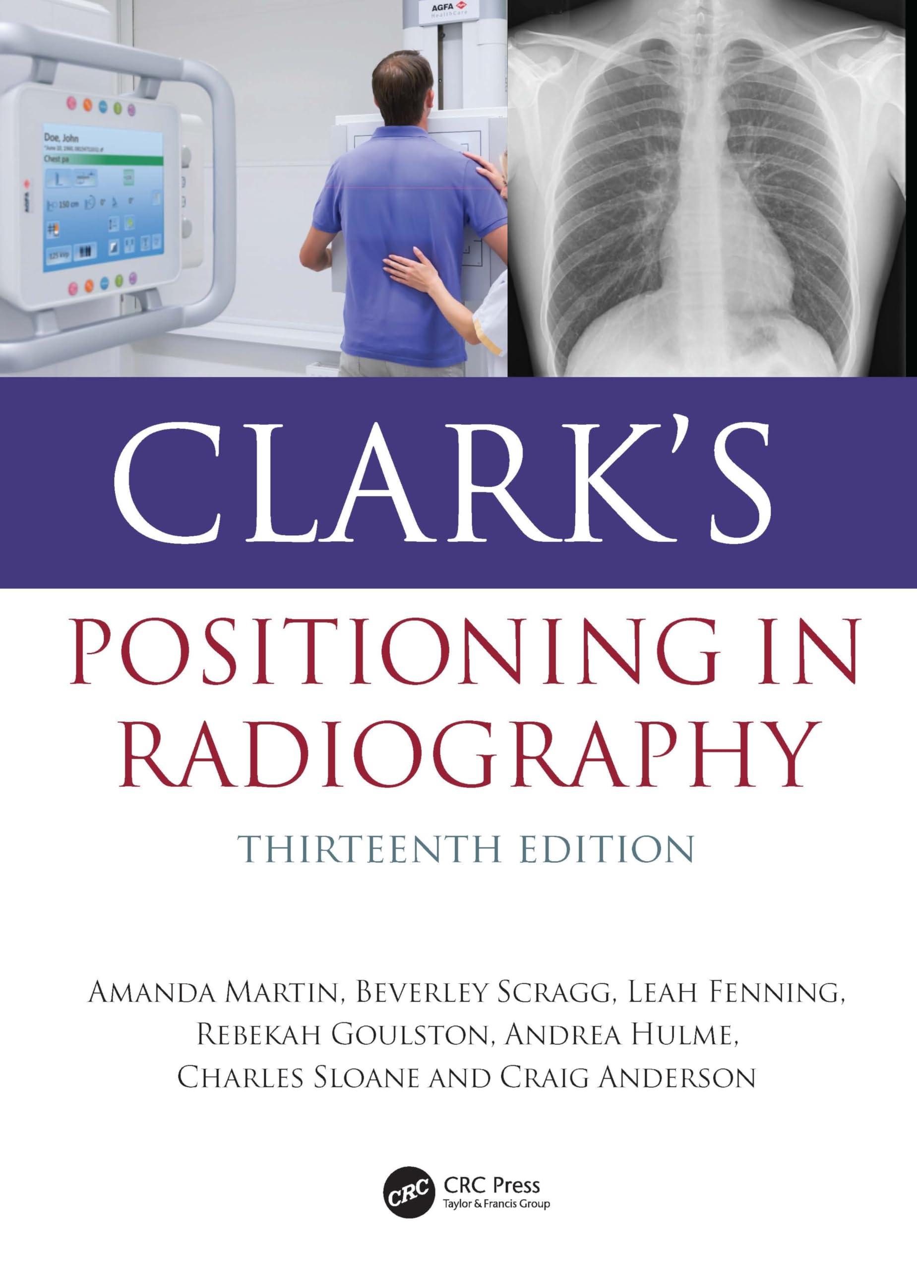 Clark's Positioning in Radiography