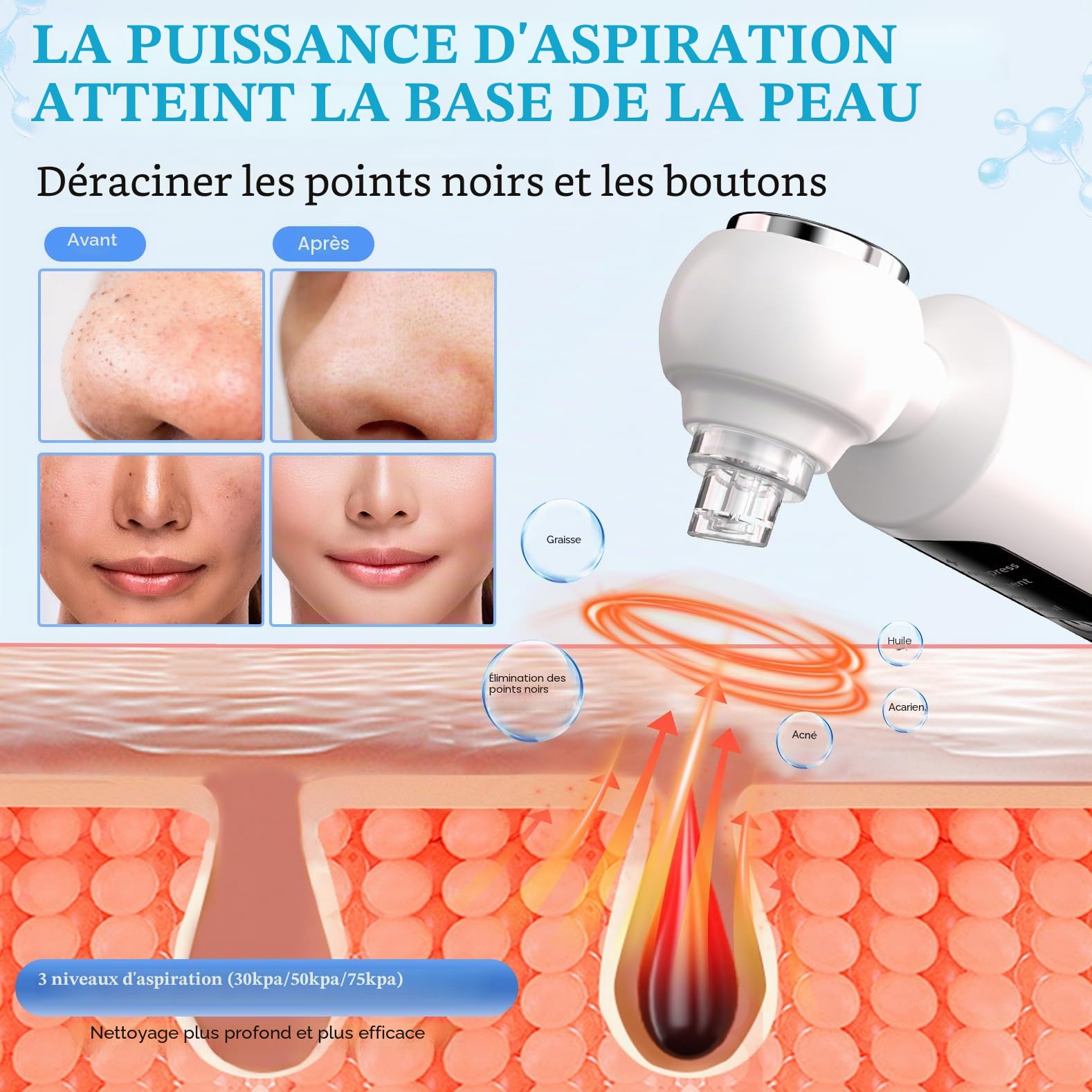 Aspirateur Points Noirs, Extracteur Points Noirs Visage, 4 Modes, 6 Sondes, 75 kPa Super puissance d'aspiration pour le Nettoyage du Visage, Traitement de l'acné et Soins de la Peau