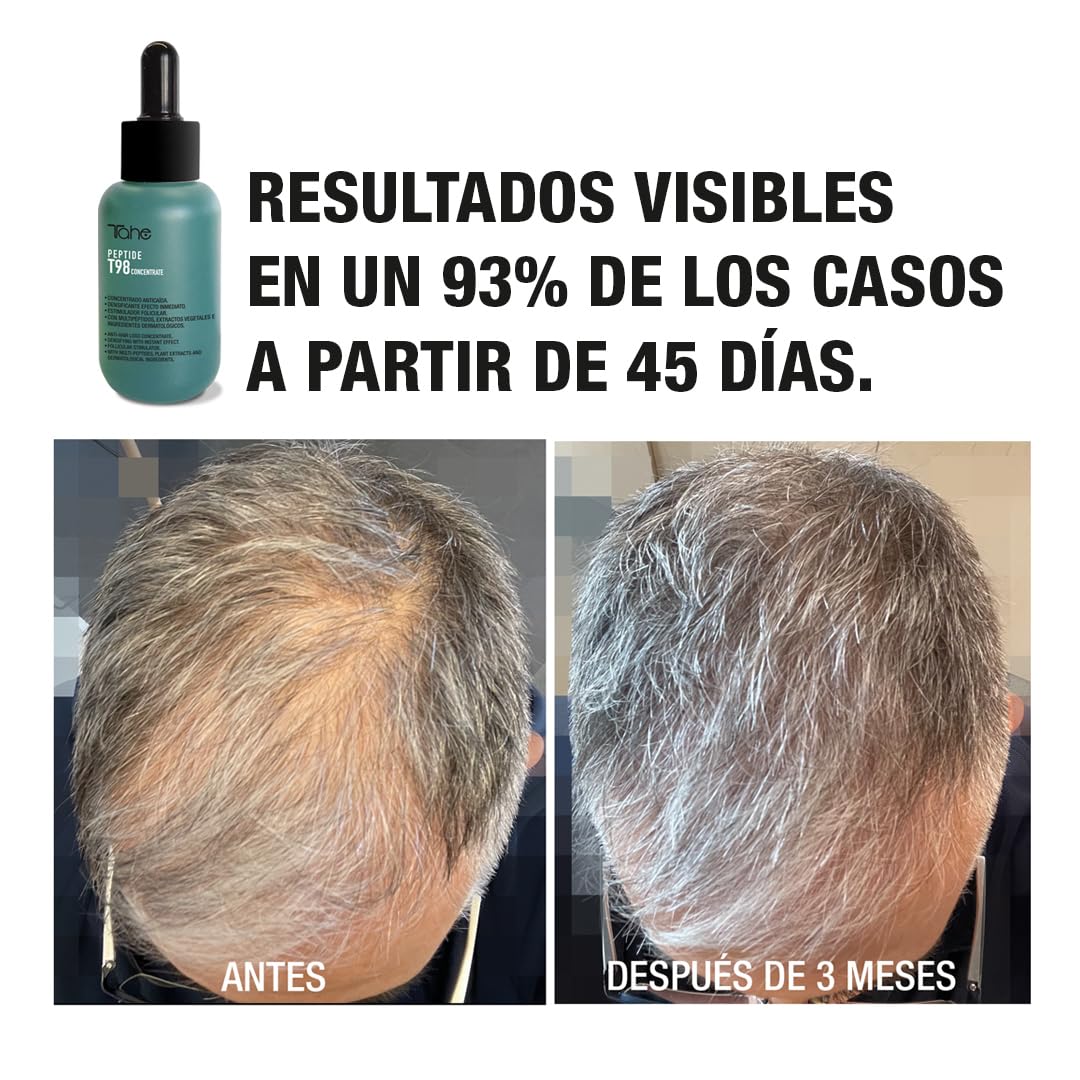 Tahe Peptide T98 Tratamiento concentrado anticaída capilar densificante con multipéptidos de efecto inmediato (50 ml (Paquete de 1))