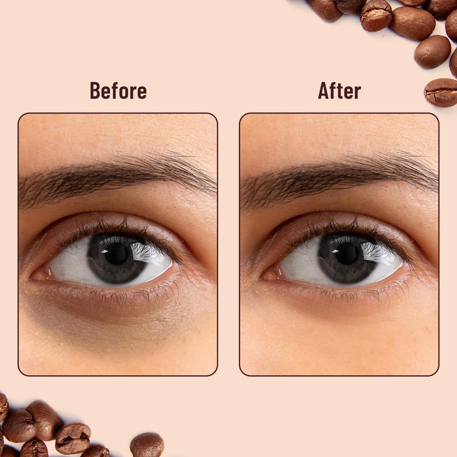 Under Eye Patches with Green Tea & Collagen for Puffy Eyes, Hydrogel under eye patches with instant cooling serum - 30 Pairs [COFFEE] - Image 8 thumbnail