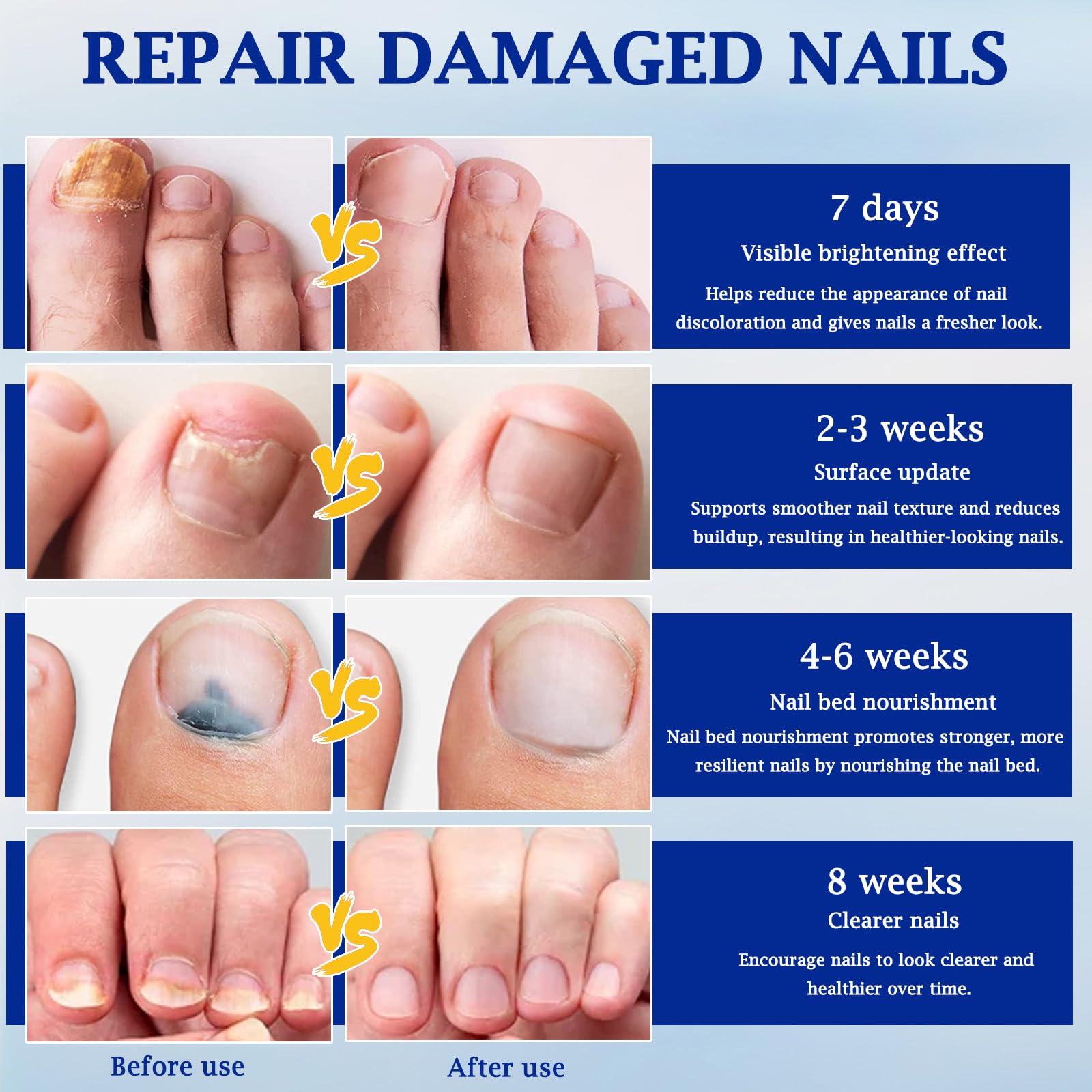 Fungal Nail Patches, Cuscinetti Multiuso per la Riparazione delle Unghie dei Piedi – Trattamento per Micosi delle Unghie dei Piedi Extra Forte, per Riparare Unghie Danneggiate (A)