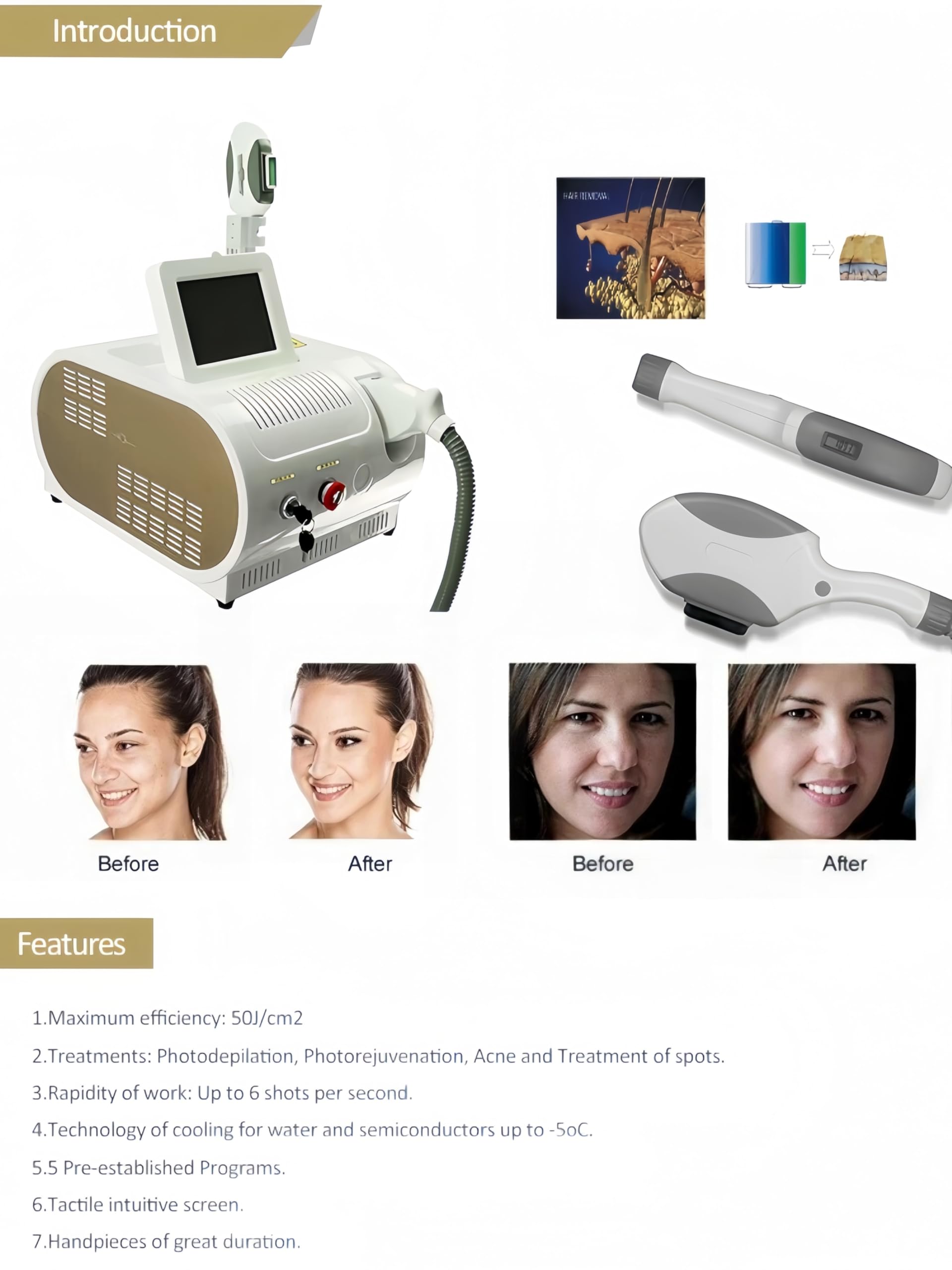 Nowy Salon piękności IPL przenośny depilacja skóry bielenie stałe laserowe maszyna do depilacji stałe laserowe OPT