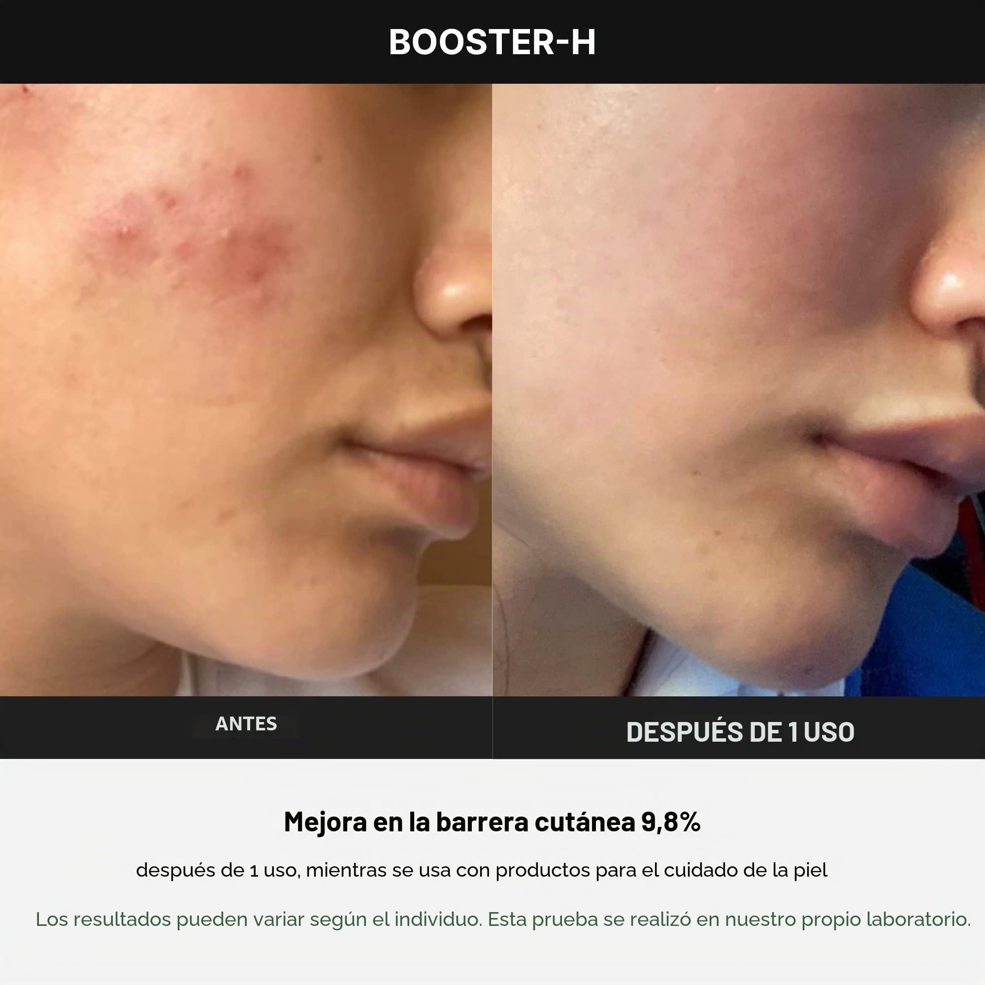 Medicube Age-R Booster H - Dispositivo coreano para el cuidado de