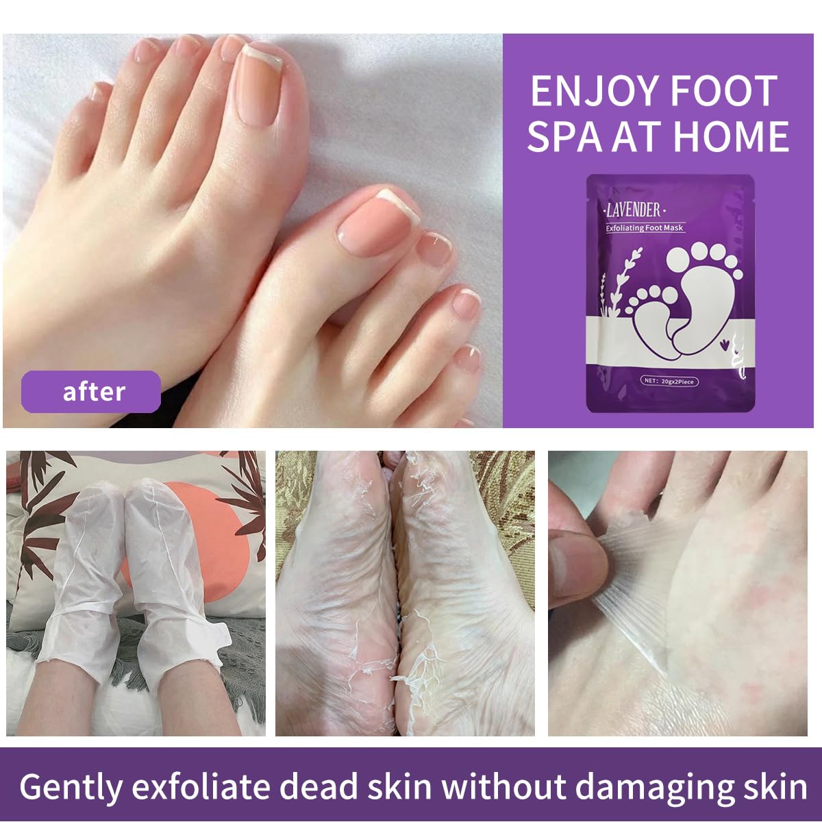 Foot Peel Mask & Exfoliating Socks - Hydrates Dry Cracked Feet, Removes Dead Skin and Calluses for Men and Women - Professional Foot Care​ (12PCS)