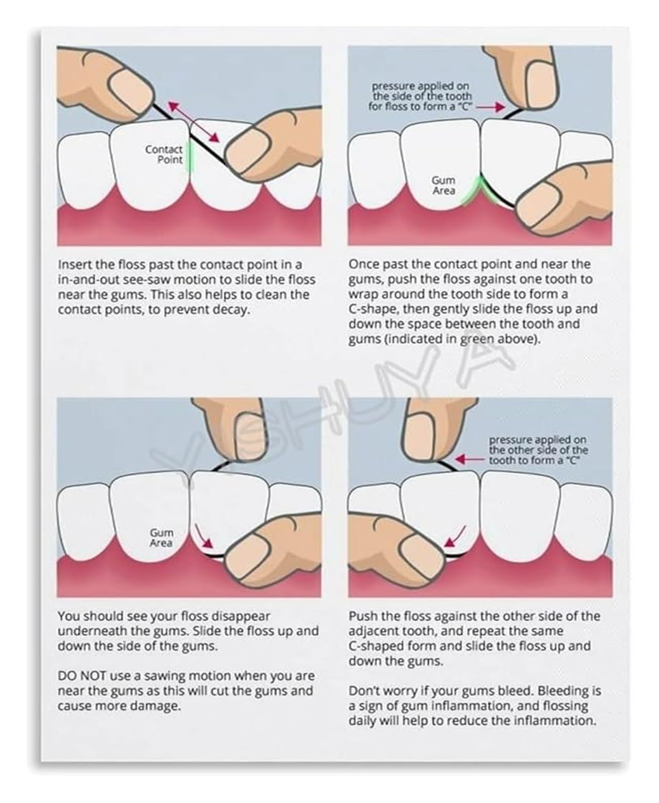 PKNVKZIDK How to Floss Teeth Properly Step by Step Guide Care Poster Wall-Art for Bathroom Clinic Oral Hygiene Framed,08x12inch(20x30cm)