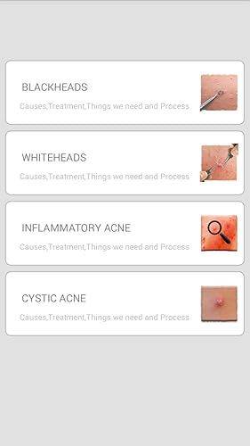 Get Rid Of Blackhead Naturally