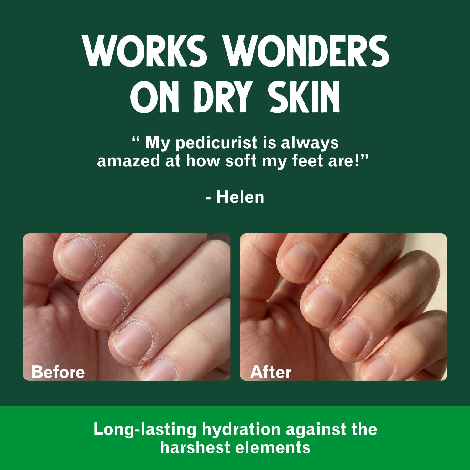 Bag Balm: Original Skin Moisturizer - Dry Skin Relief -4