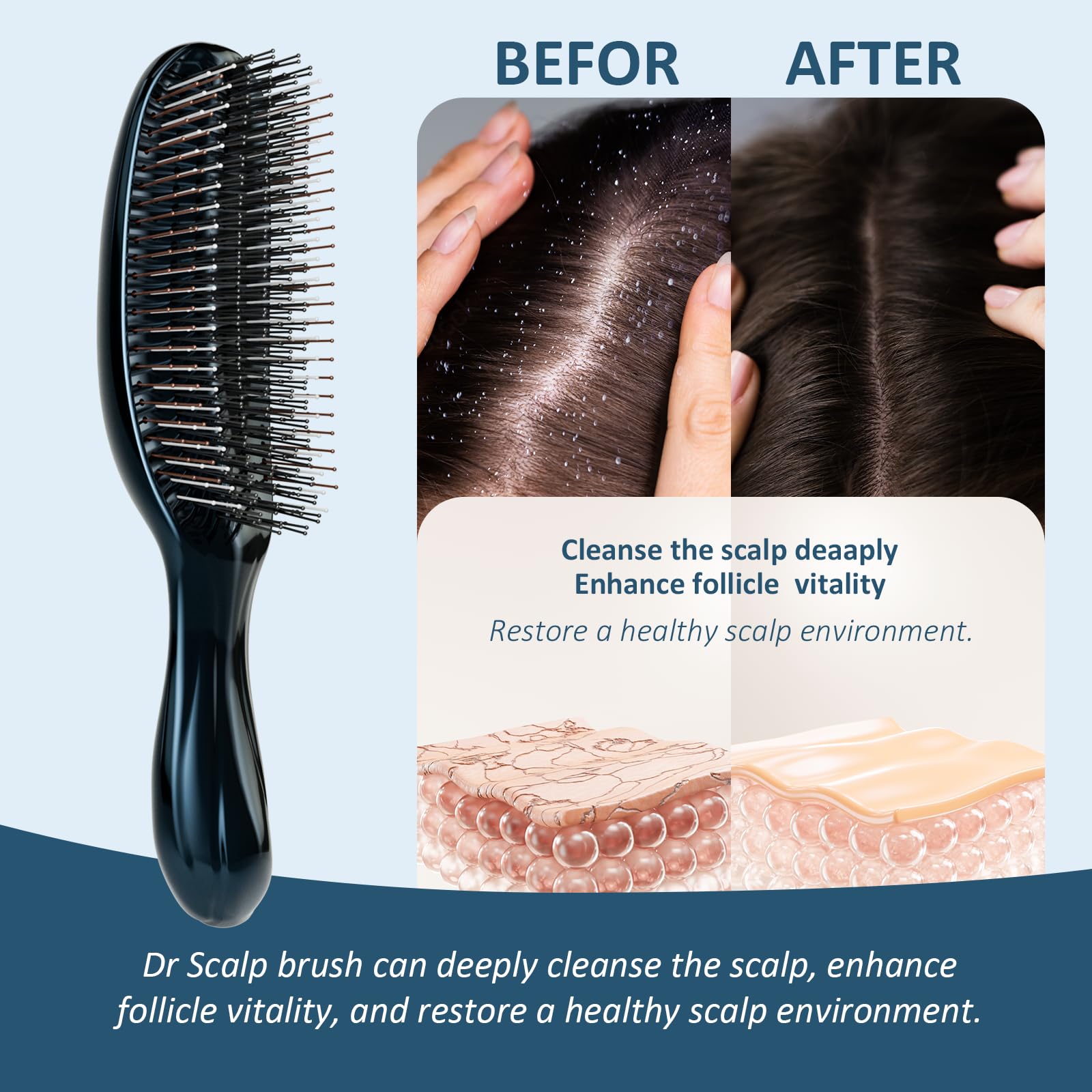 Amazon.com : Dr Scalp Hair Brush, 572 Soft Nylon Bristles for 