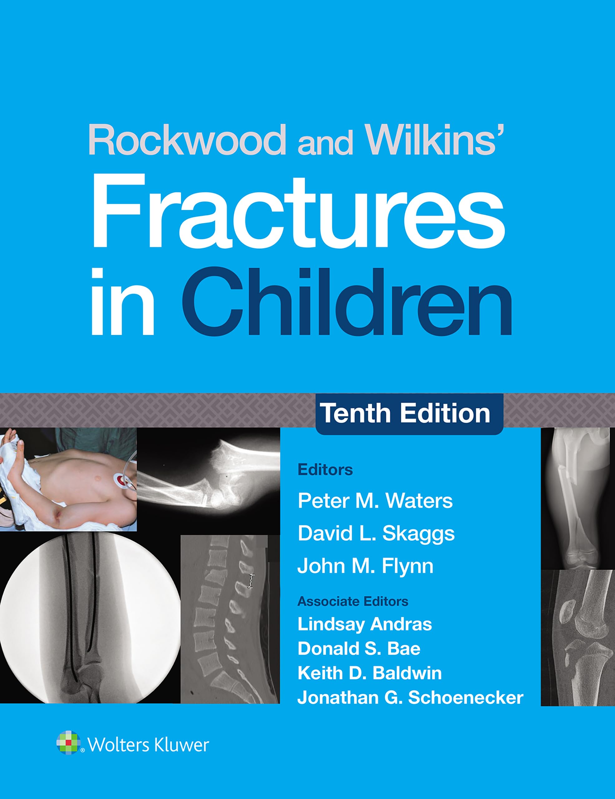 Rockwood and Wilkins' Fractures in Children: eBook without Multimedia (English Edition)