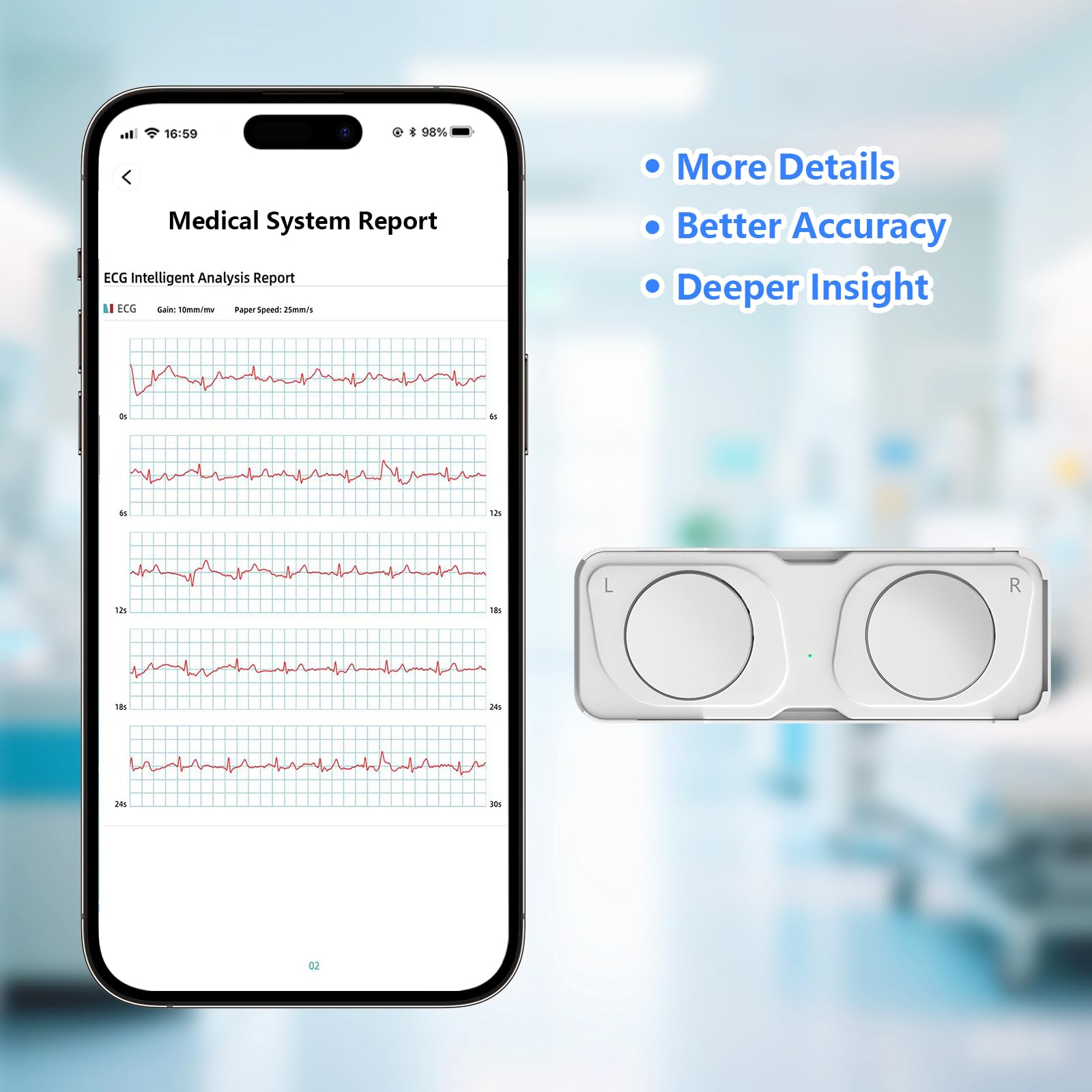 Portable ECG Monitor, Heart Rate Monitor Device for Home Use, Compatible with Smartphone, No Subscription - 4