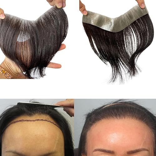 Miniatura 1 de Voloria Extensiones frontales de cabello humano para mujer, línea capilar para la frente, línea capilar de poliuretano, repuesto para el cabello