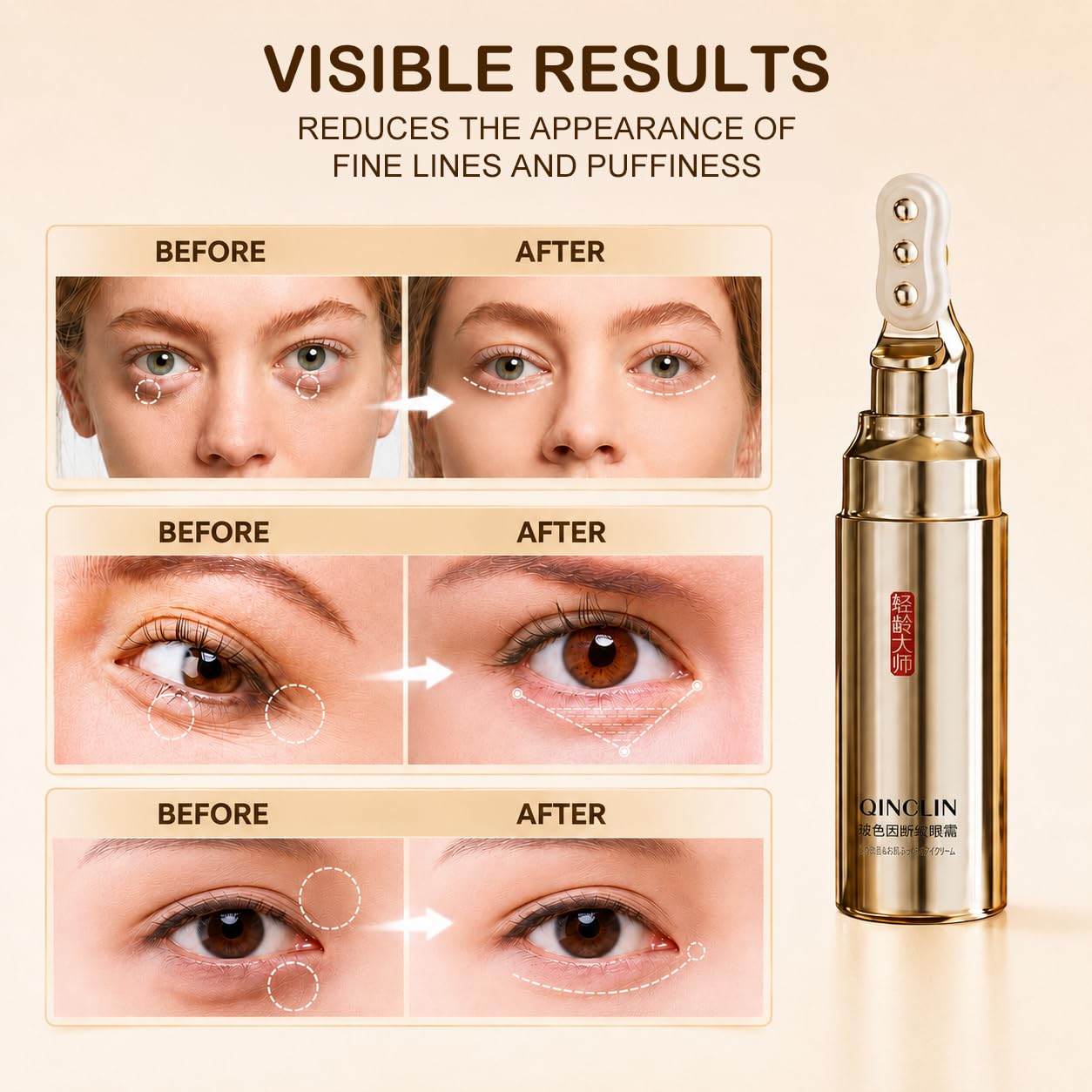 QINGLIN Koffein Augencreme Anti-Aging gegen Augenringe, Schwellungen und feine Linien, straffende feuchtigkeitsspendende Augenpflege für Männer und Frauen