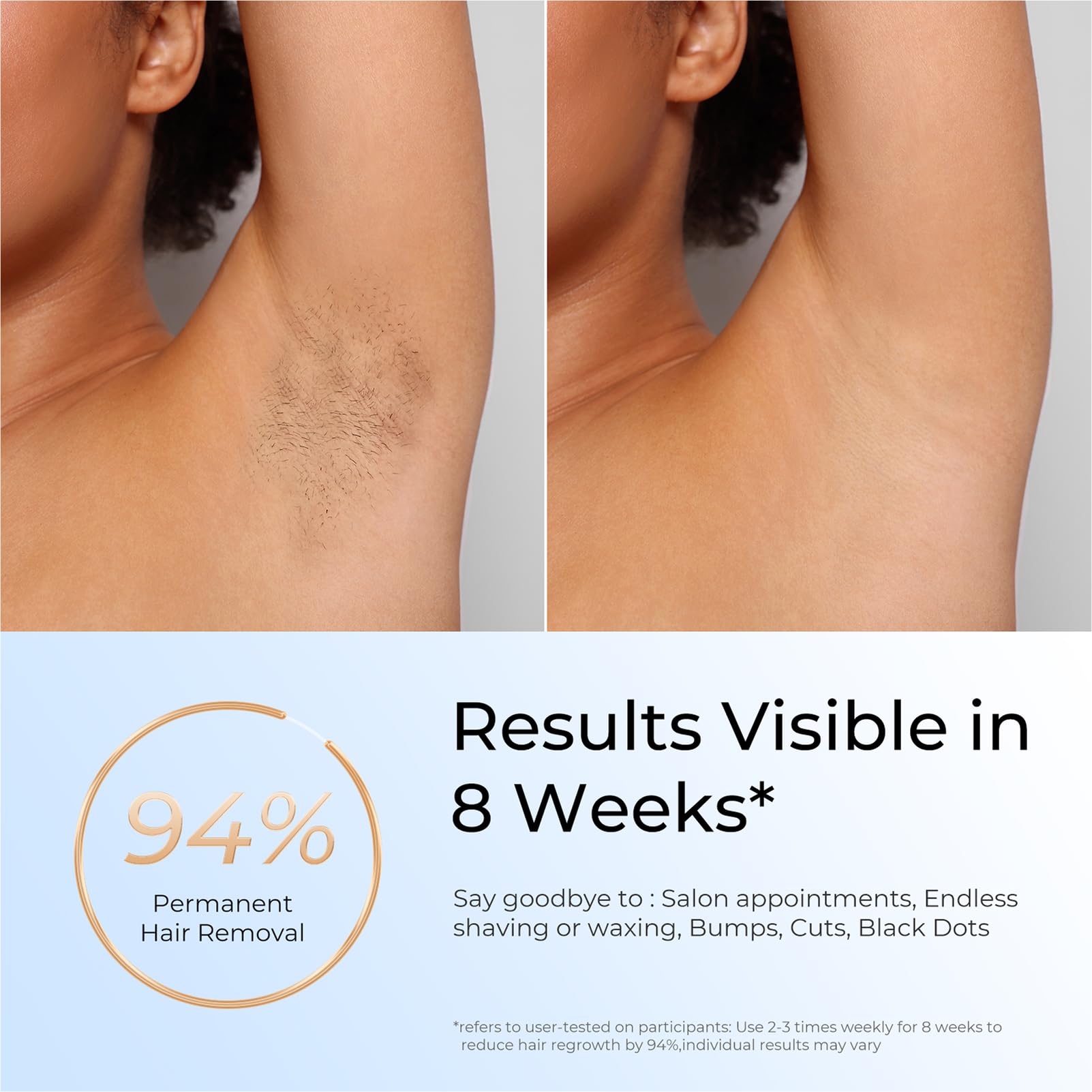 Finequin Laser Hair Removal, IPL Laser Hair Removal for Women and Men Permanent, Hair Removal Device with 3.0 IPL Red Light Wave, Home Laser Hair Removal Device for Facial Legs Armpits Bikini Body Use: Gold White