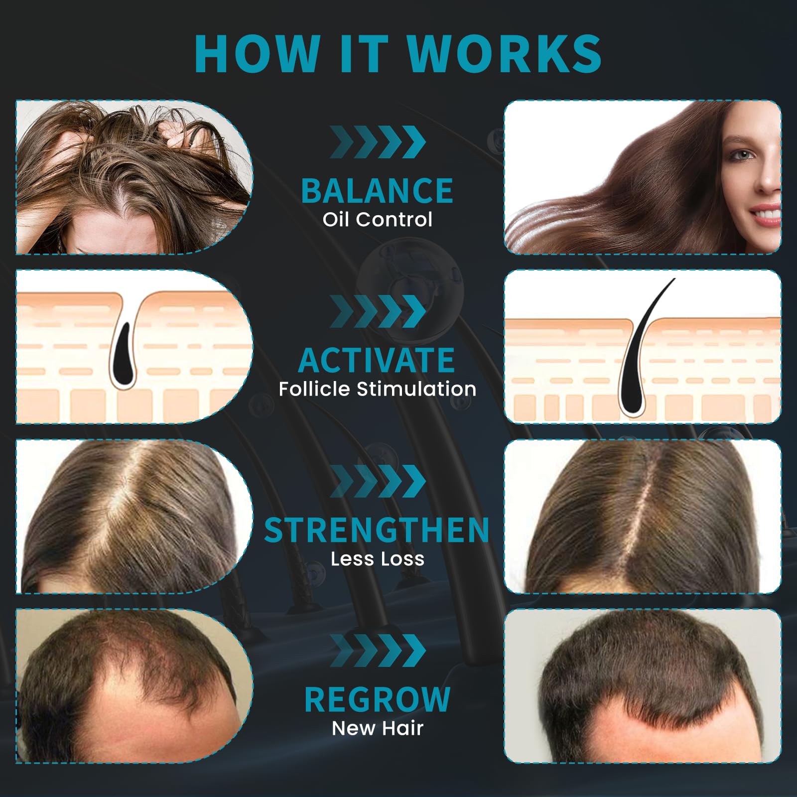 iKeener Casco Láser para Anticaída Cabello, 236 Diodos Luz Roja & Luz Azul Gorra Láser para el Crecimiento del Cabello Mujer y Hombre, 5-60 Min Ajustable